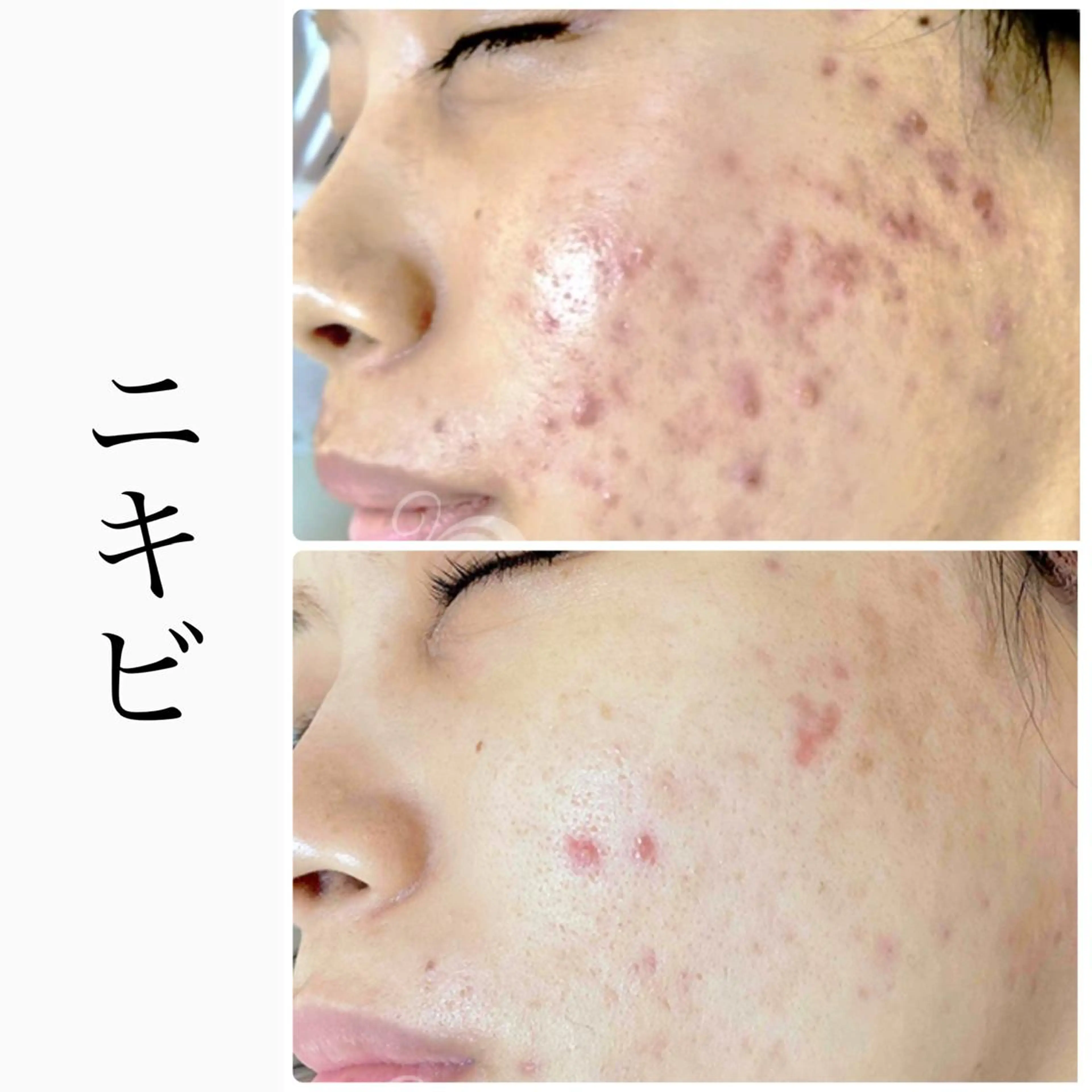 エステ ハーブピーリング専門 BIOEL横浜のエステ・リラクイメージ