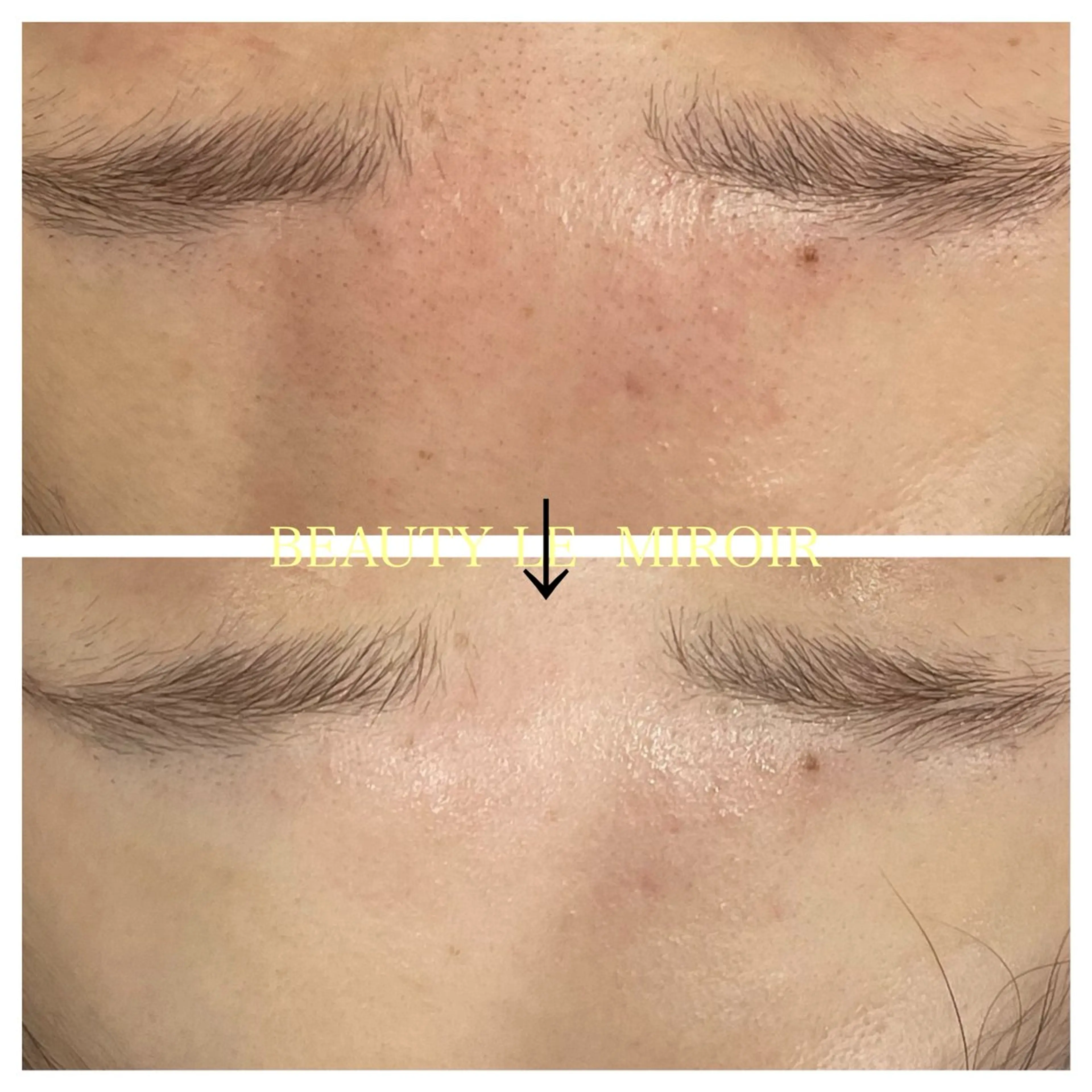 エステ ビューティー ミロワールのエステ・リラクイメージ