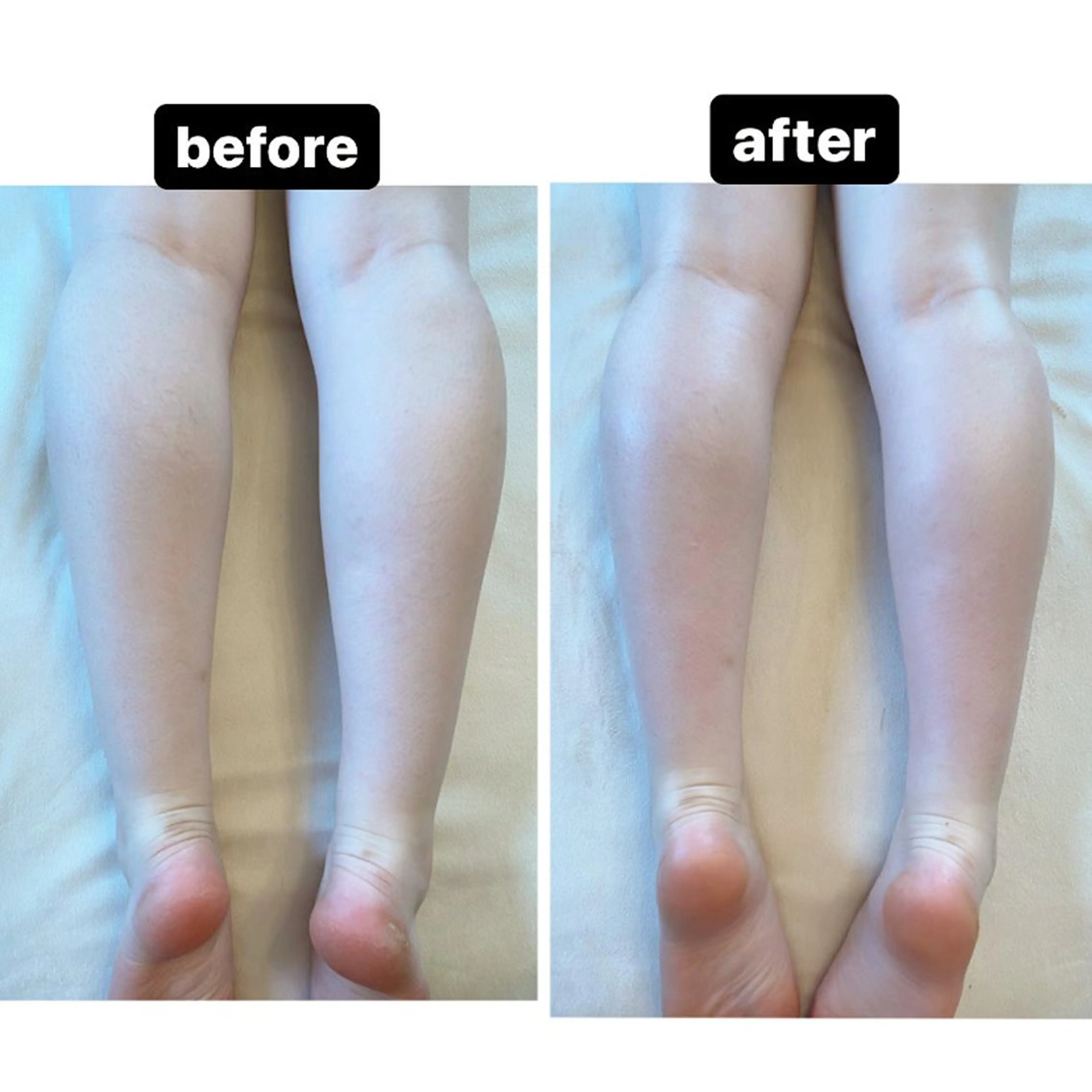 脱毛・エステサロン LuLuNのエステ・リラクイメージ