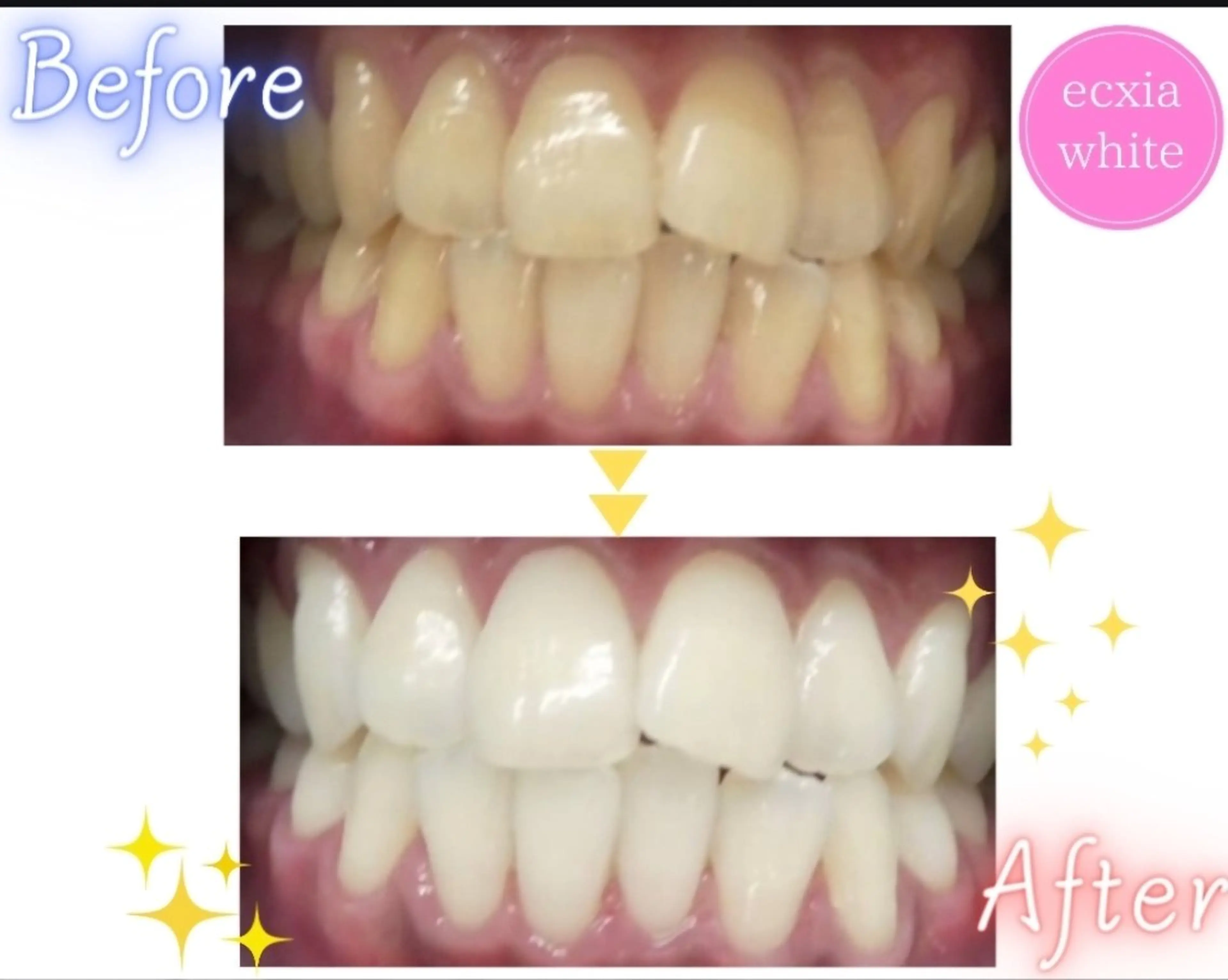 エクシアホワイト旭橋店所属・セルフホワイトニング エクシア旭橋店のその他イメージ