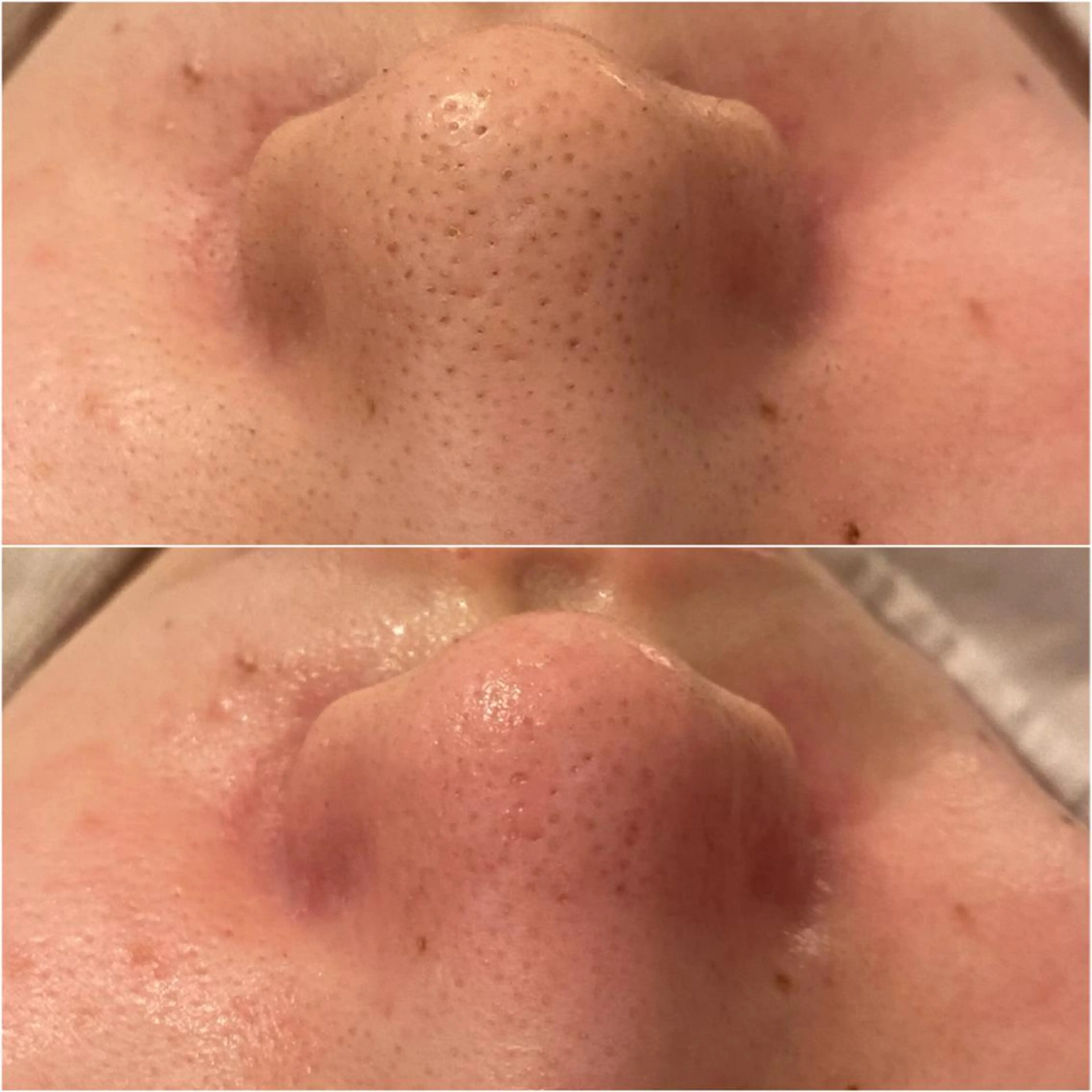 ✨美肌水光✨ アトリエリュバンのエステ・リラクイメージ