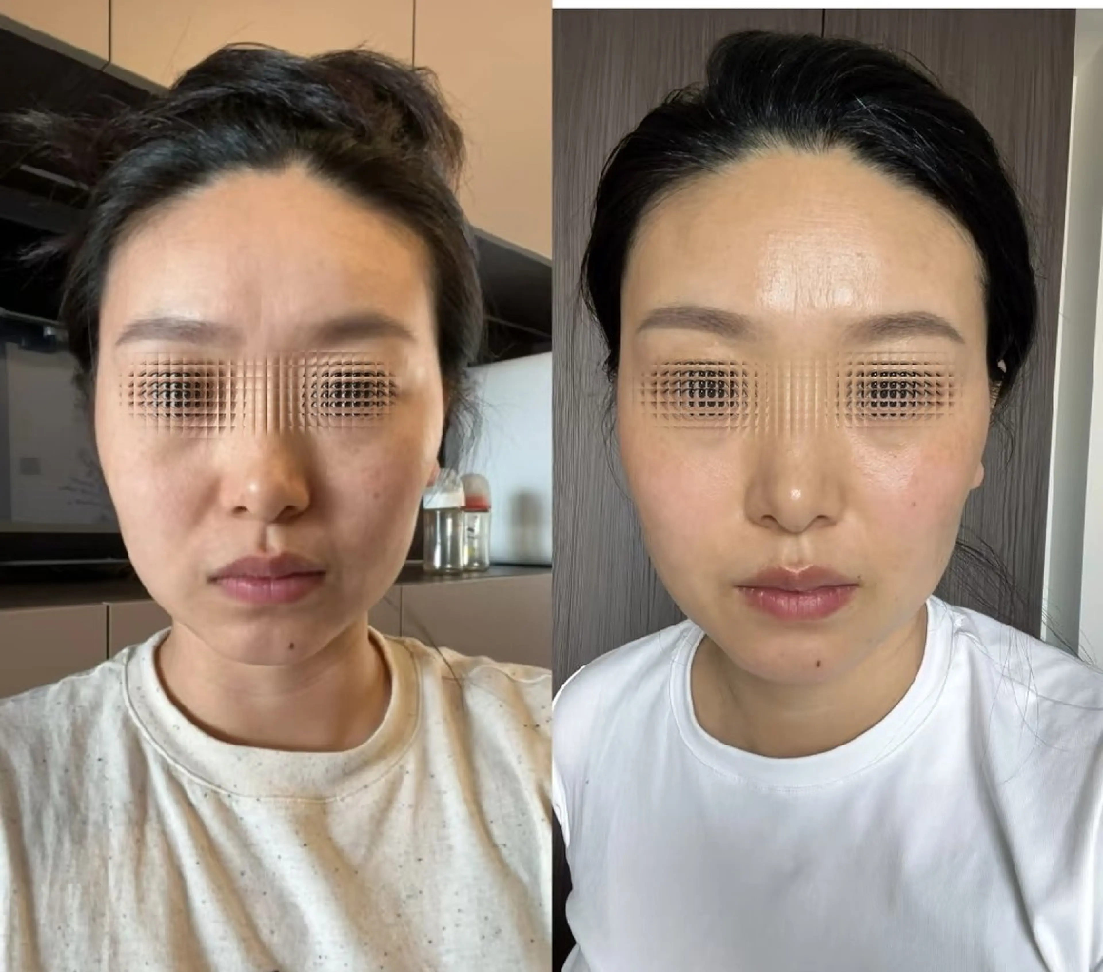 マツエク・マツパ 結婚式・ブライダル aliaハイフ&水光ジェットサロン所属・aliaハーブ水光店 エステティシャン募集のエステ・リラクイメージ