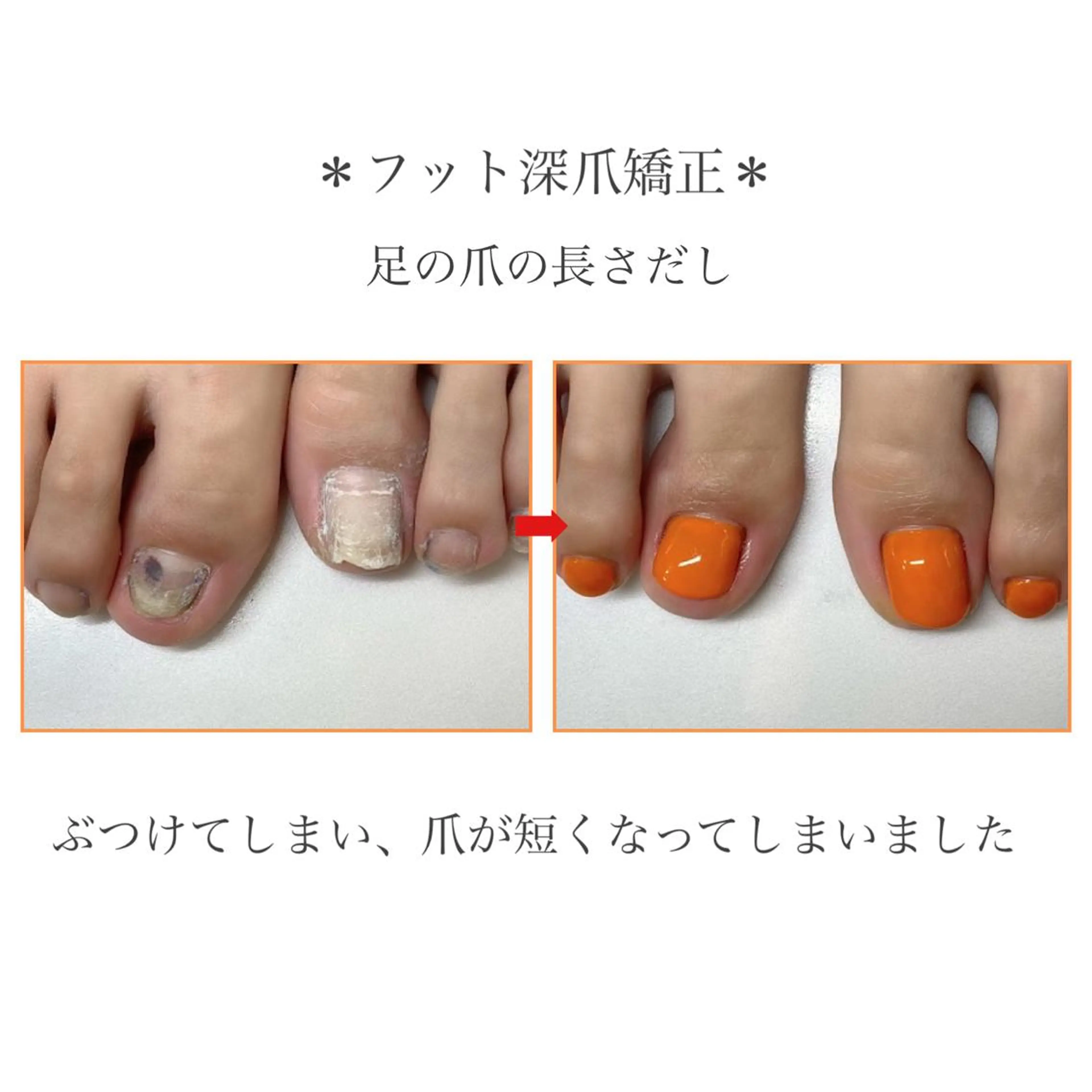 ネイル フットネイル ネイルサロンアリューム所属・ネイルサロン アリュームのネイルデザイン