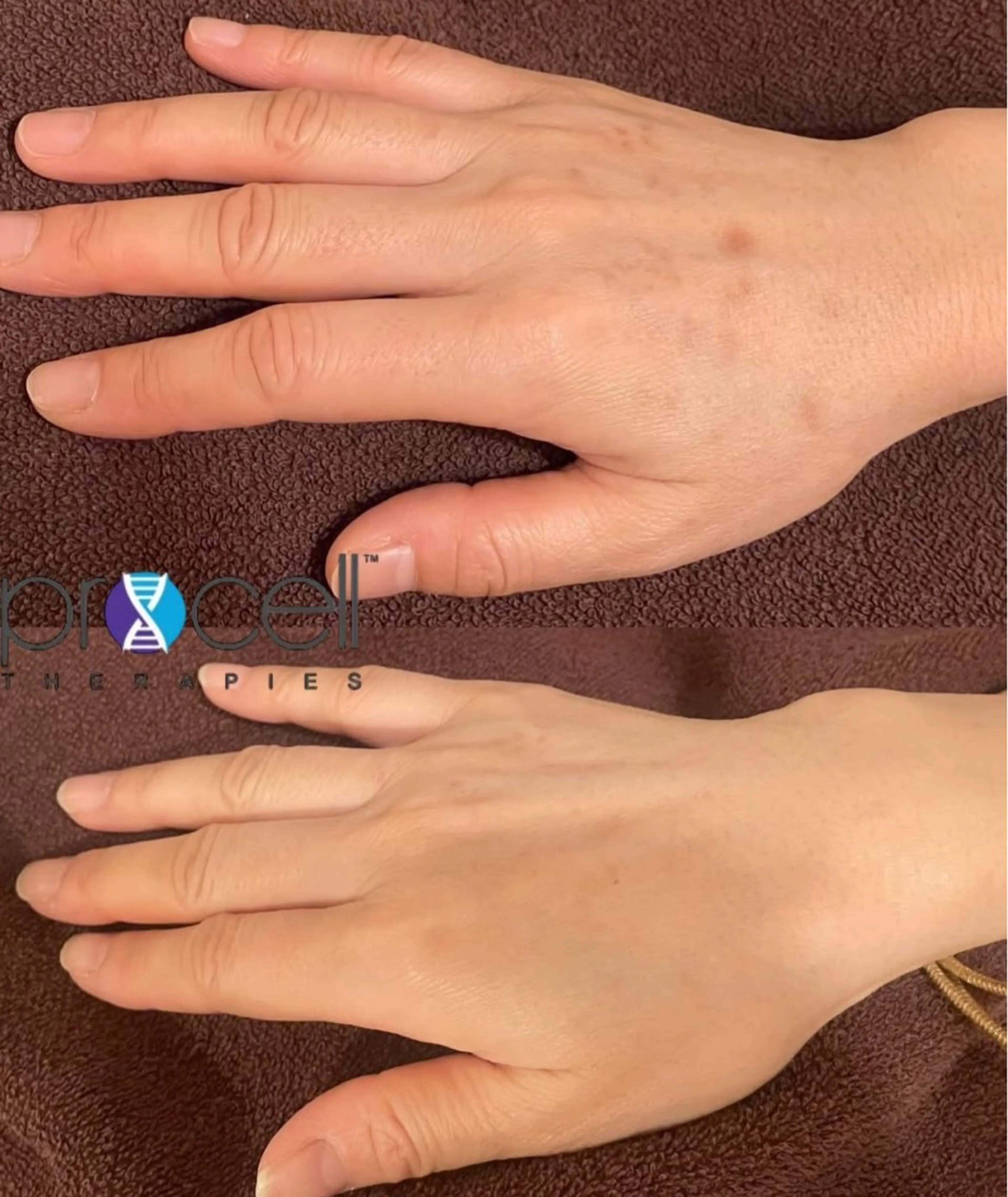 Blooming所属・LOUISE. ／肌質・頭皮のエステ・リラクイメージ