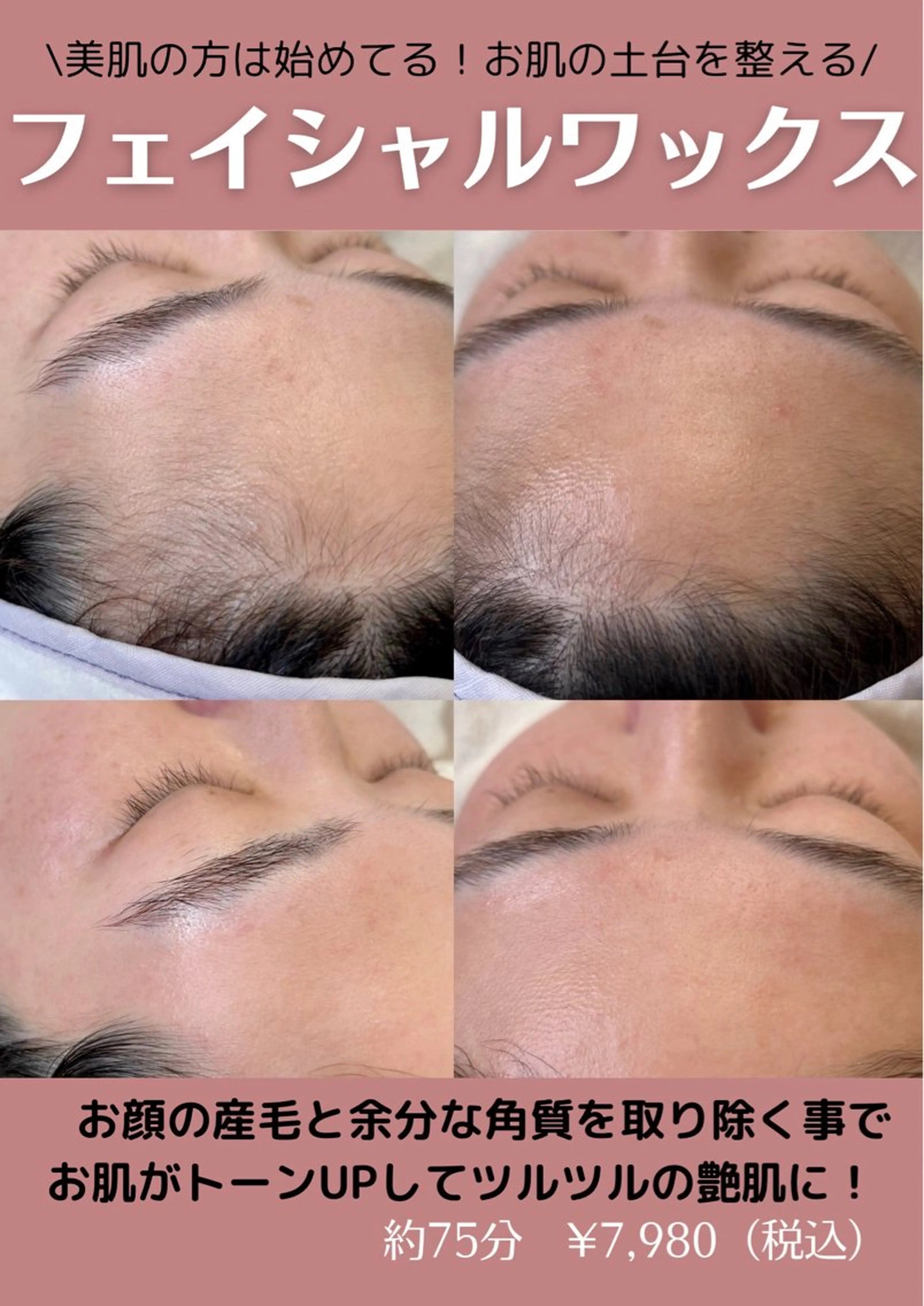 《顔脱毛＆角質ケア✨》フェイシャルワックス＋保湿パック✨の写真