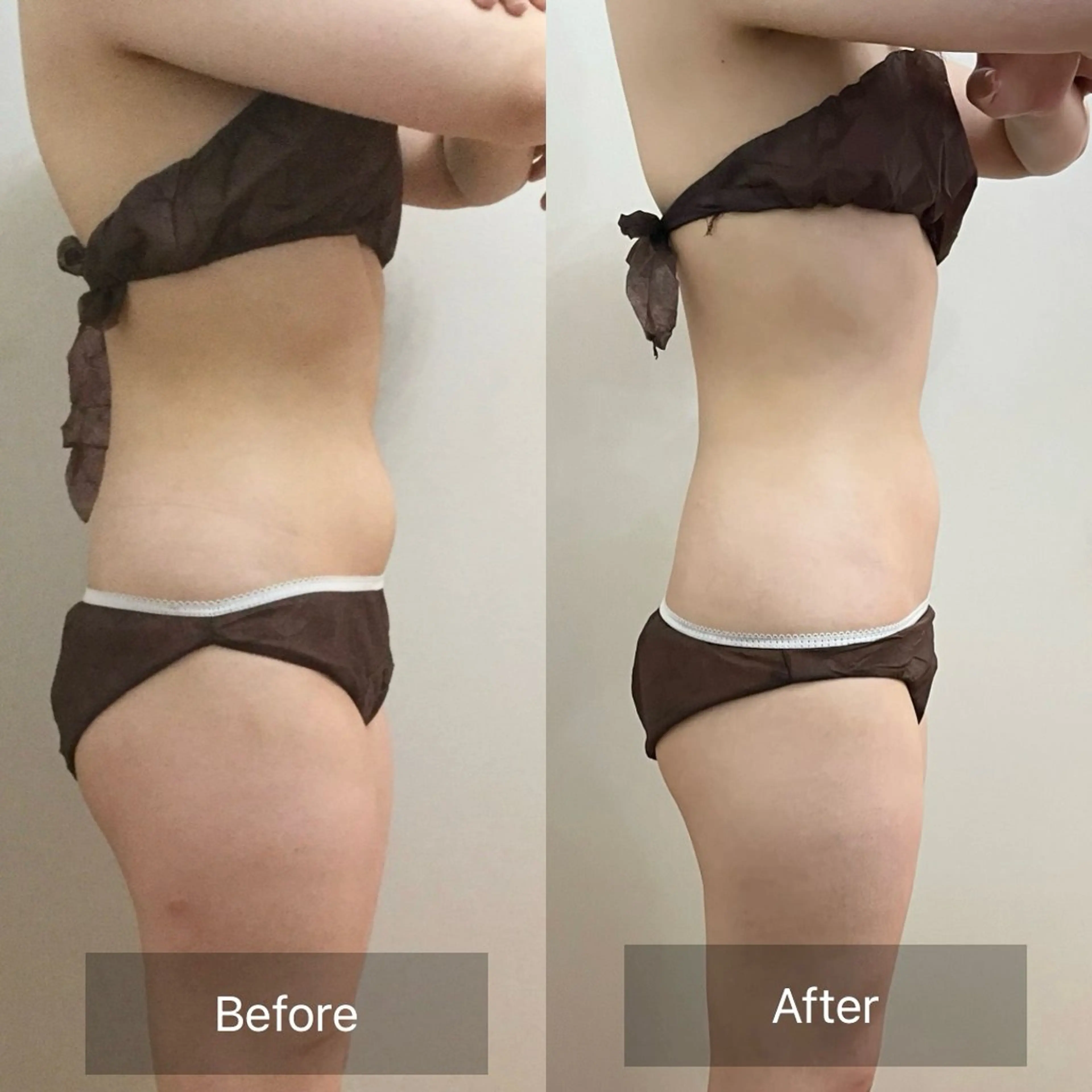 その他 宮崎 みおのエステ・リラクイメージ