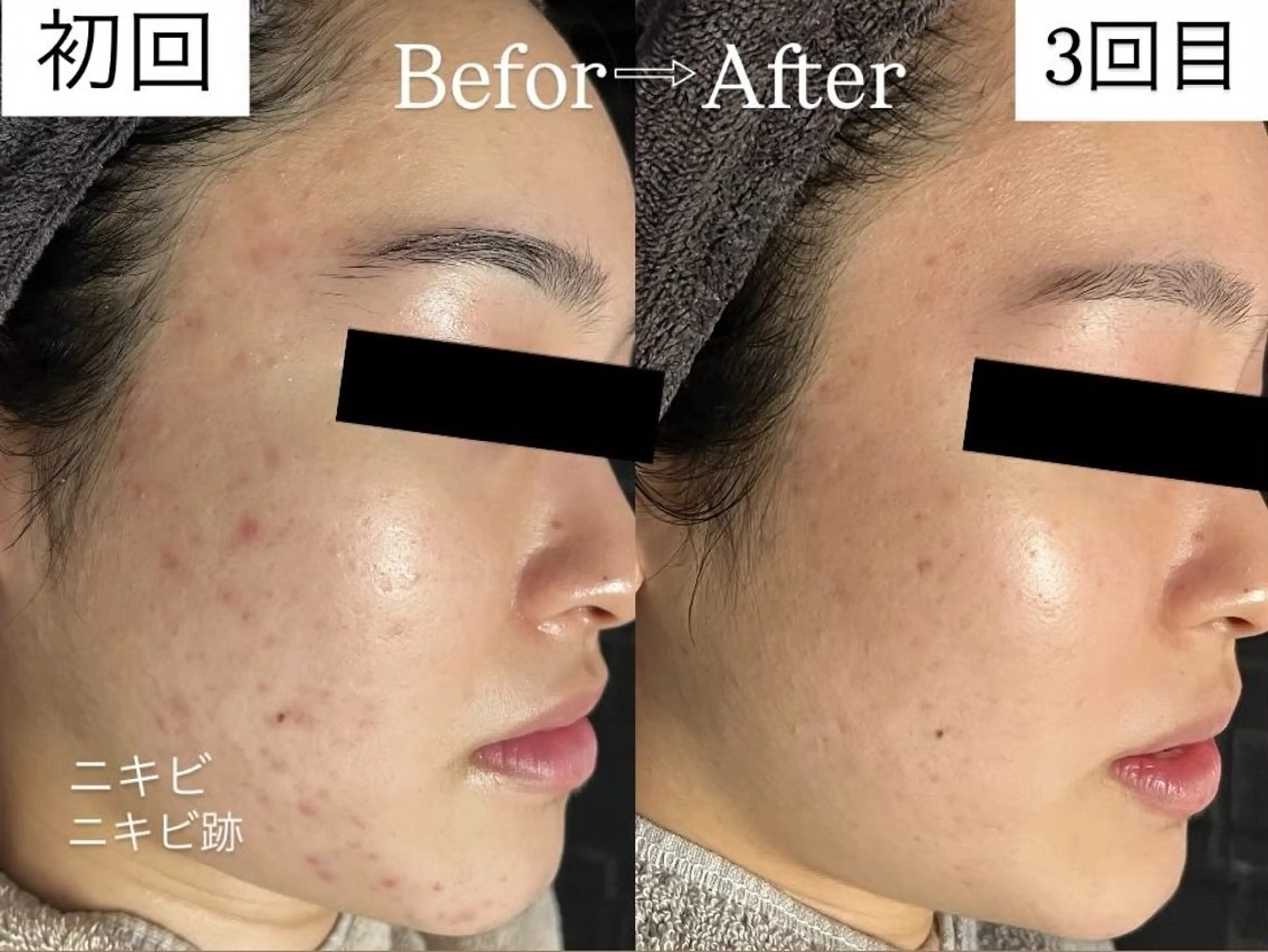 rejena 山口のエステ・リラクイメージ