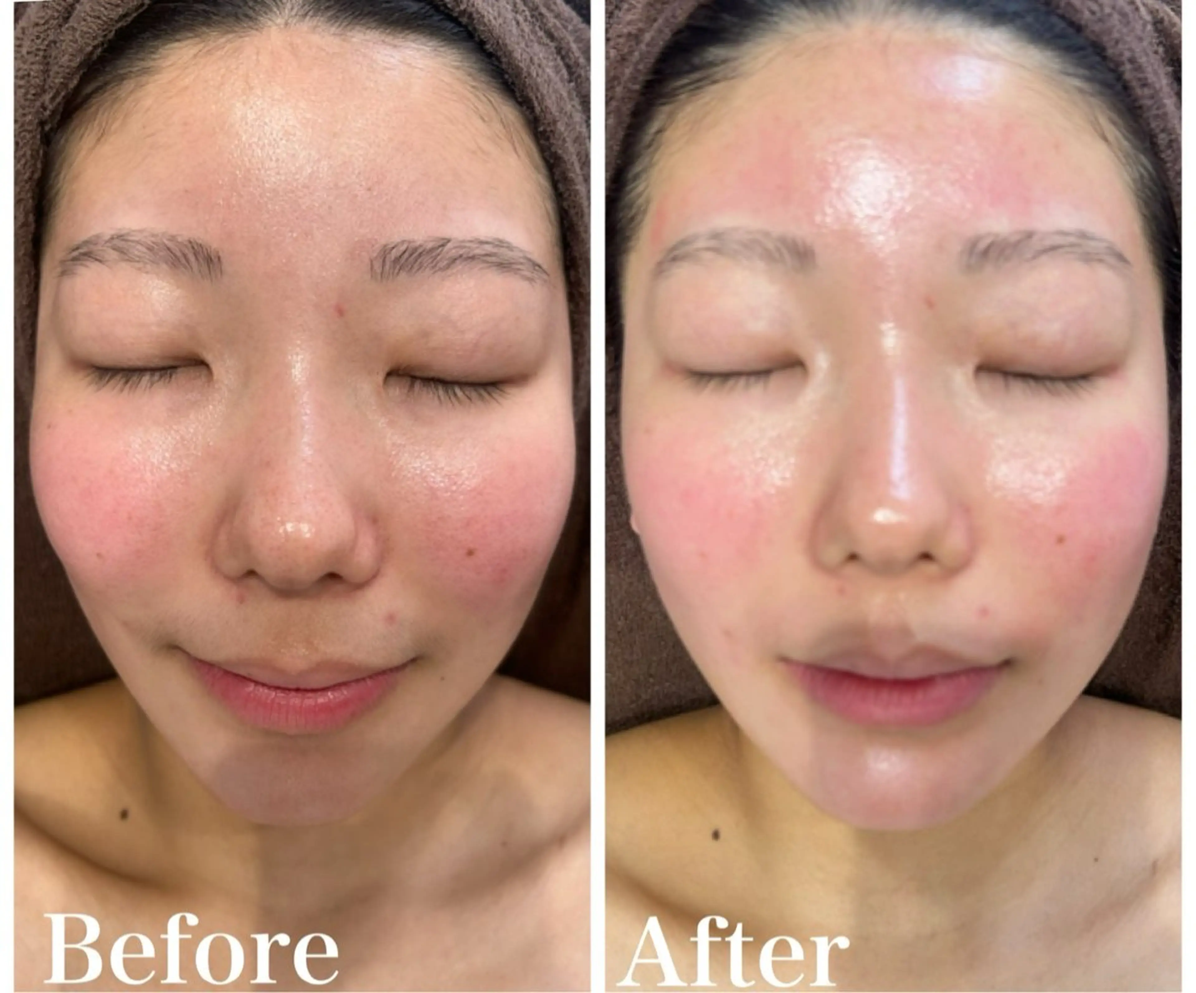 脱毛 LAKI eye&face  studio所属・LAKI studioのエステ・リラクイメージ