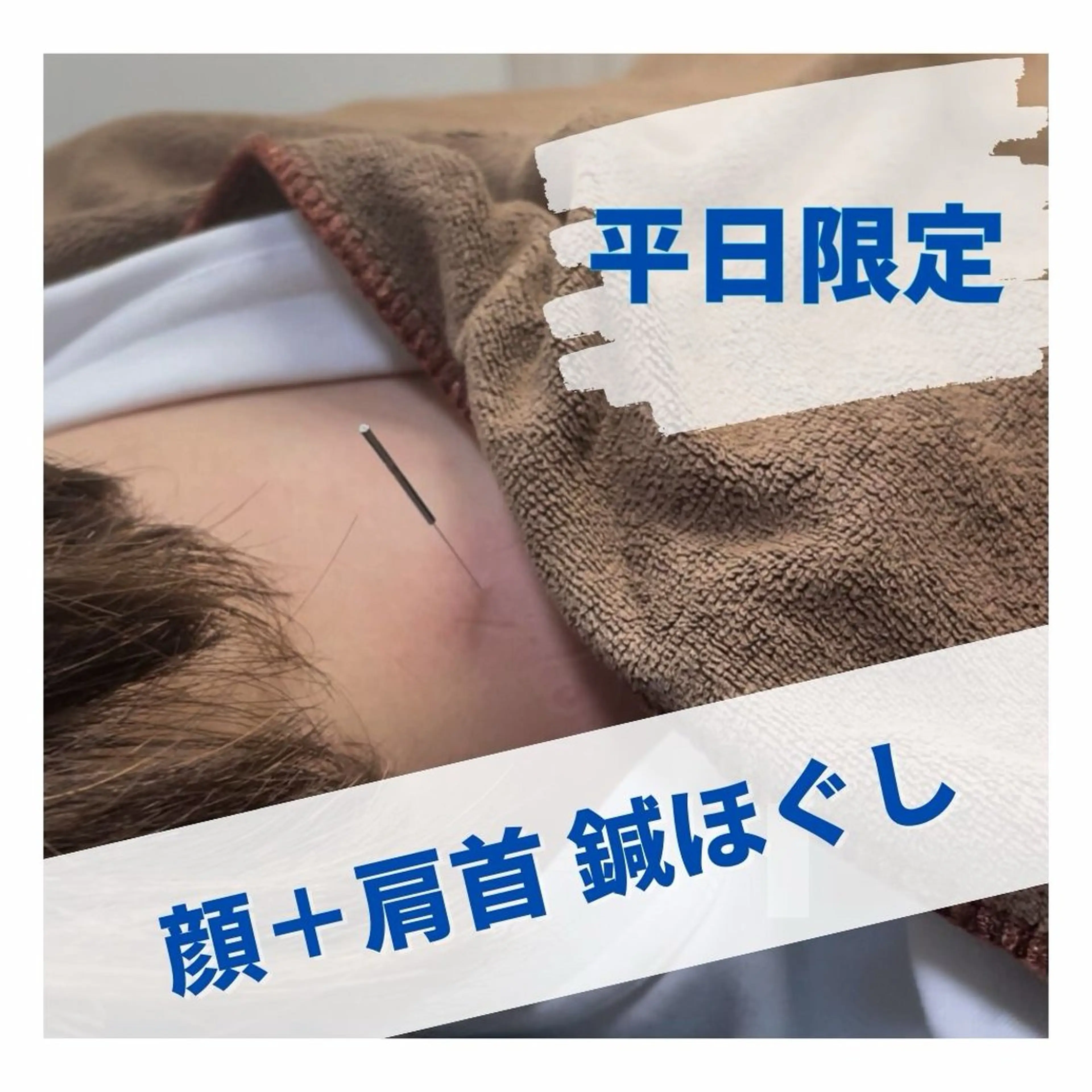 W2鍼灸整骨院 CORILABOのエステ・リラクイメージ