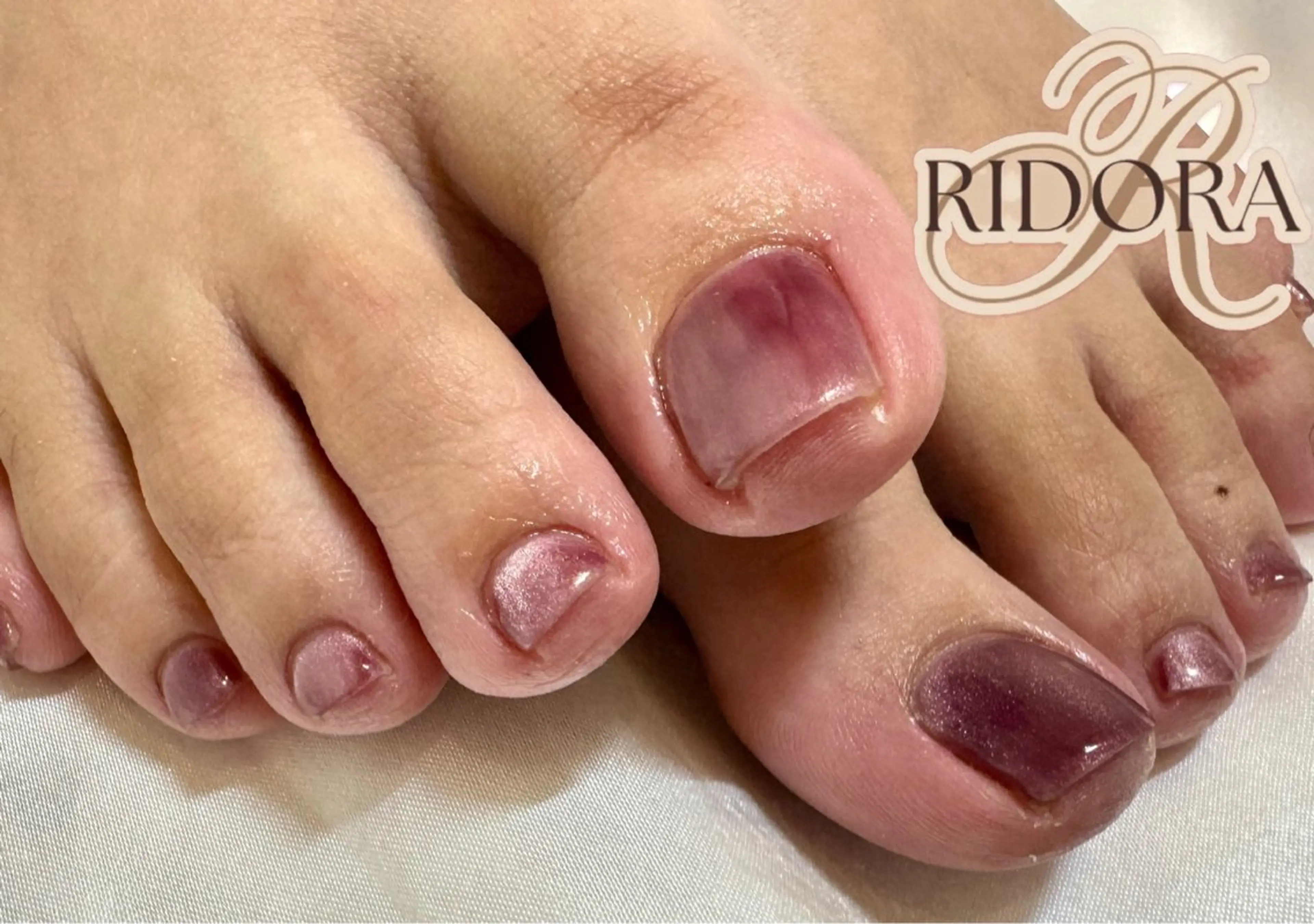 ネイル フットネイル RIDORA nailのネイルデザイン