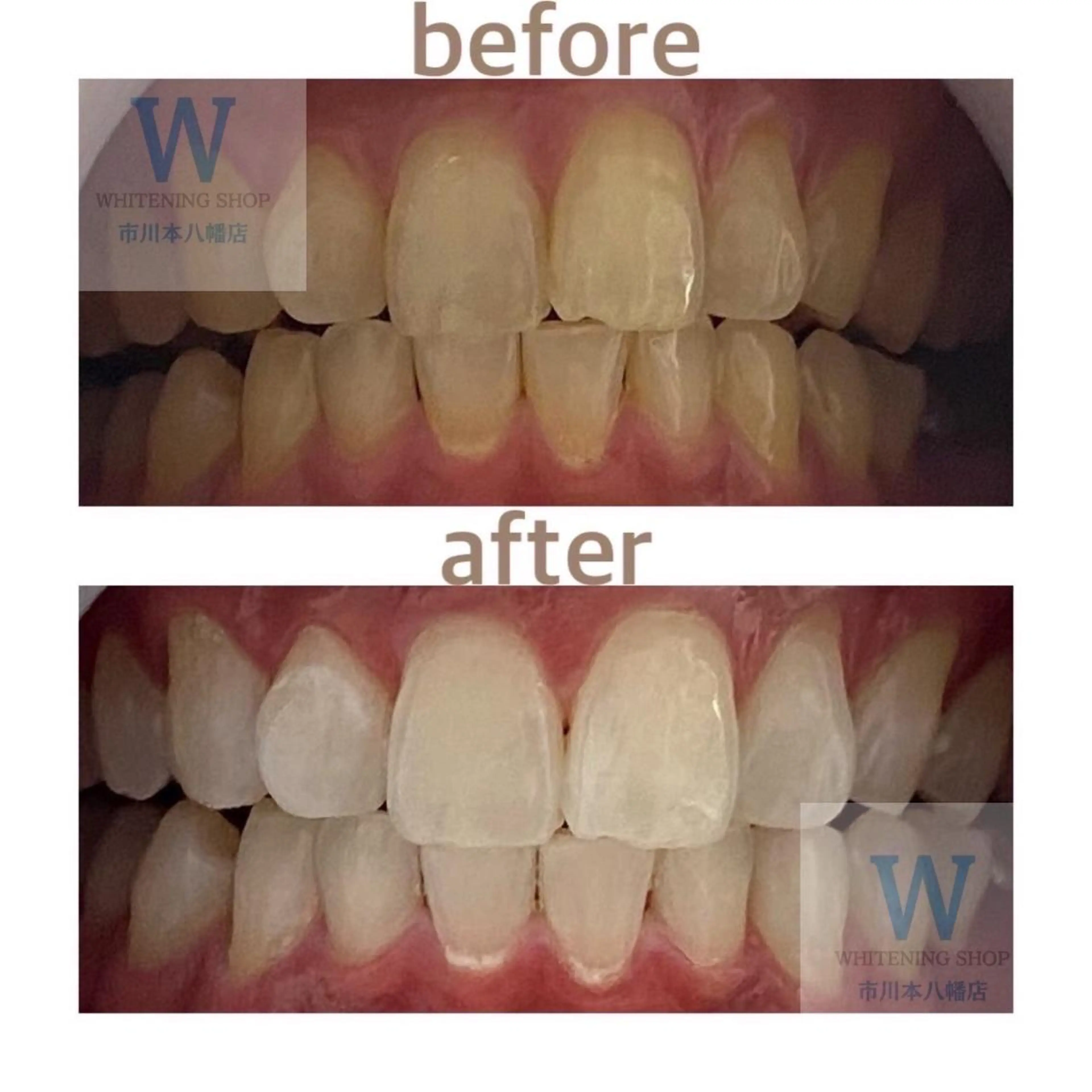 ホワイトニング ショップ本八幡店のエステ・リラクイメージ