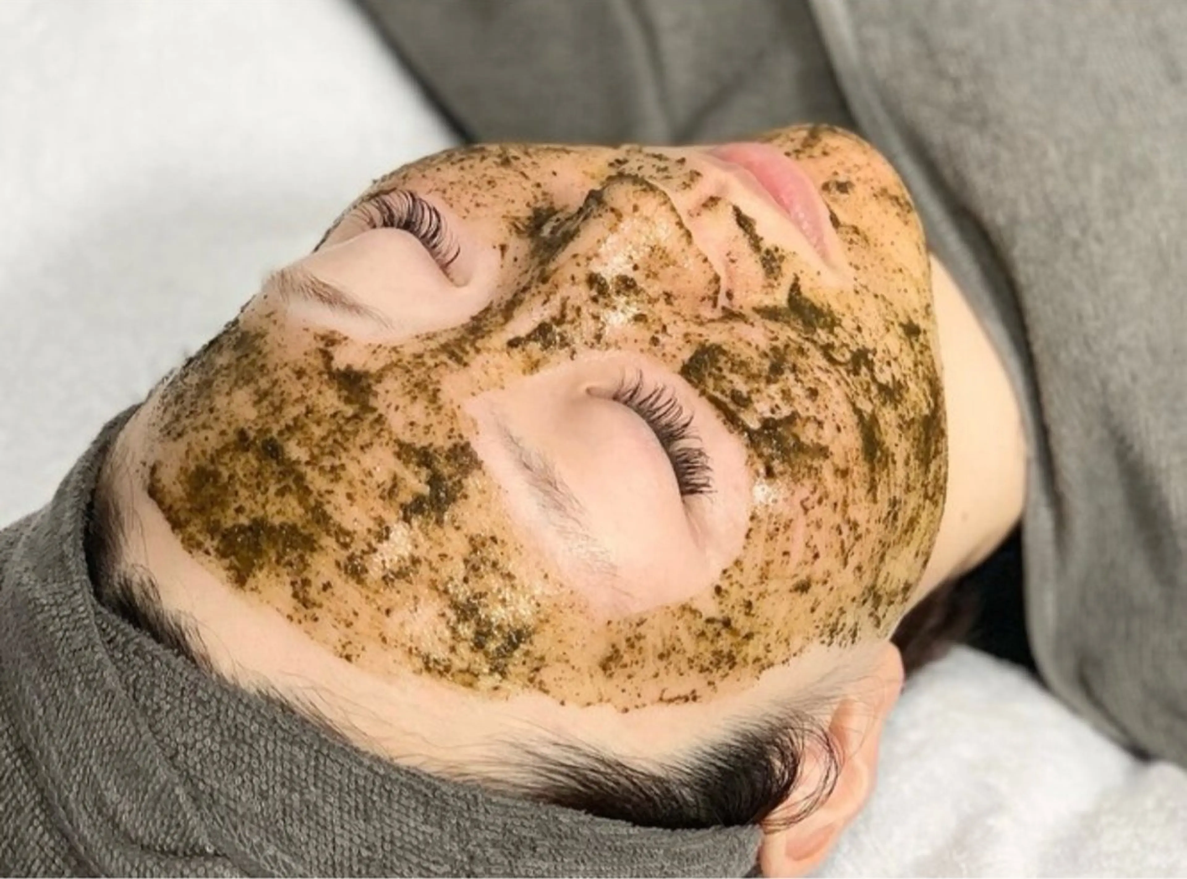 🎀平日限定🎀クリスティーナ💎ビオフィート🌿ハーブピーリングの写真