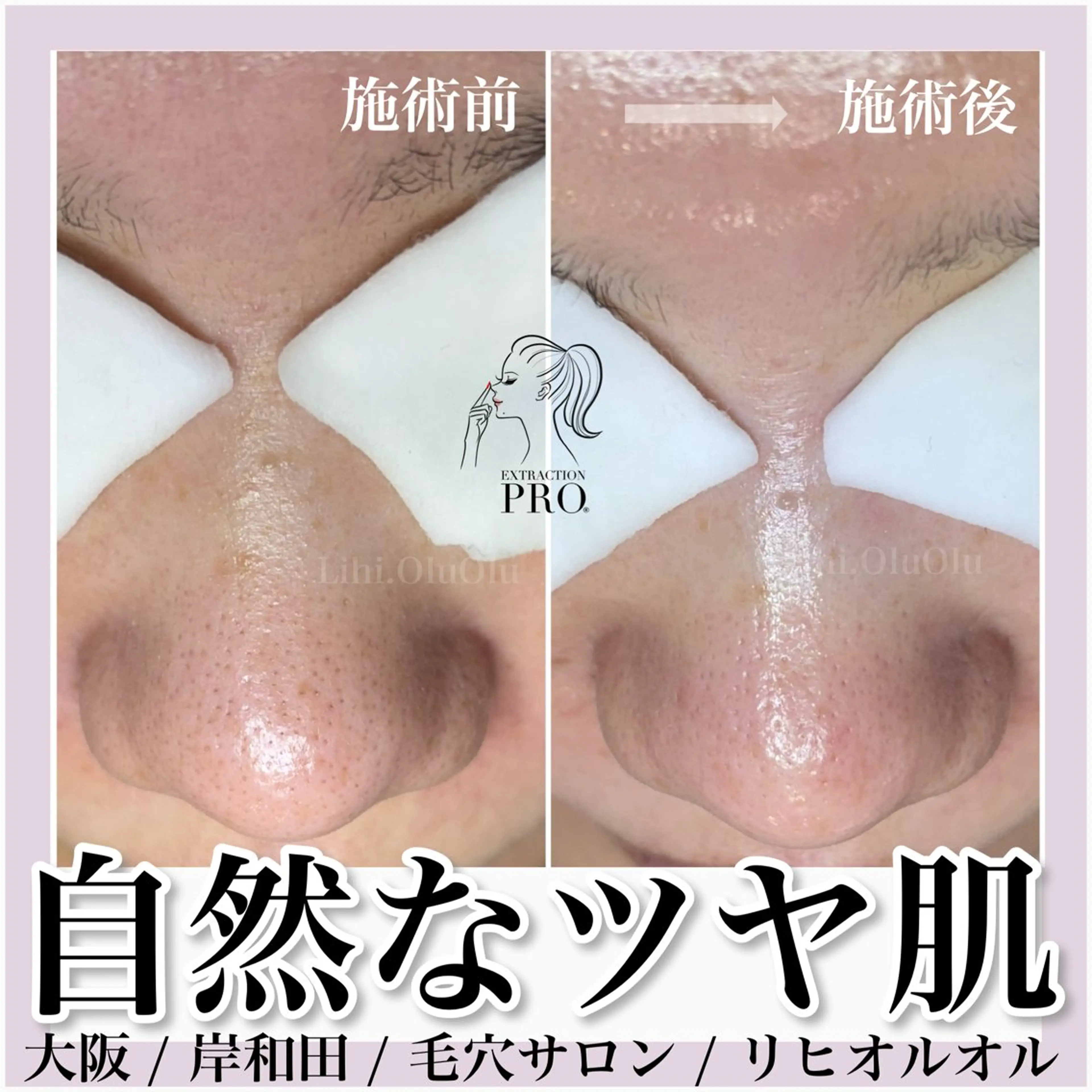 毛穴汚れ改善専門店/ 岸和田/リヒオルオルのエステ・リラクイメージ