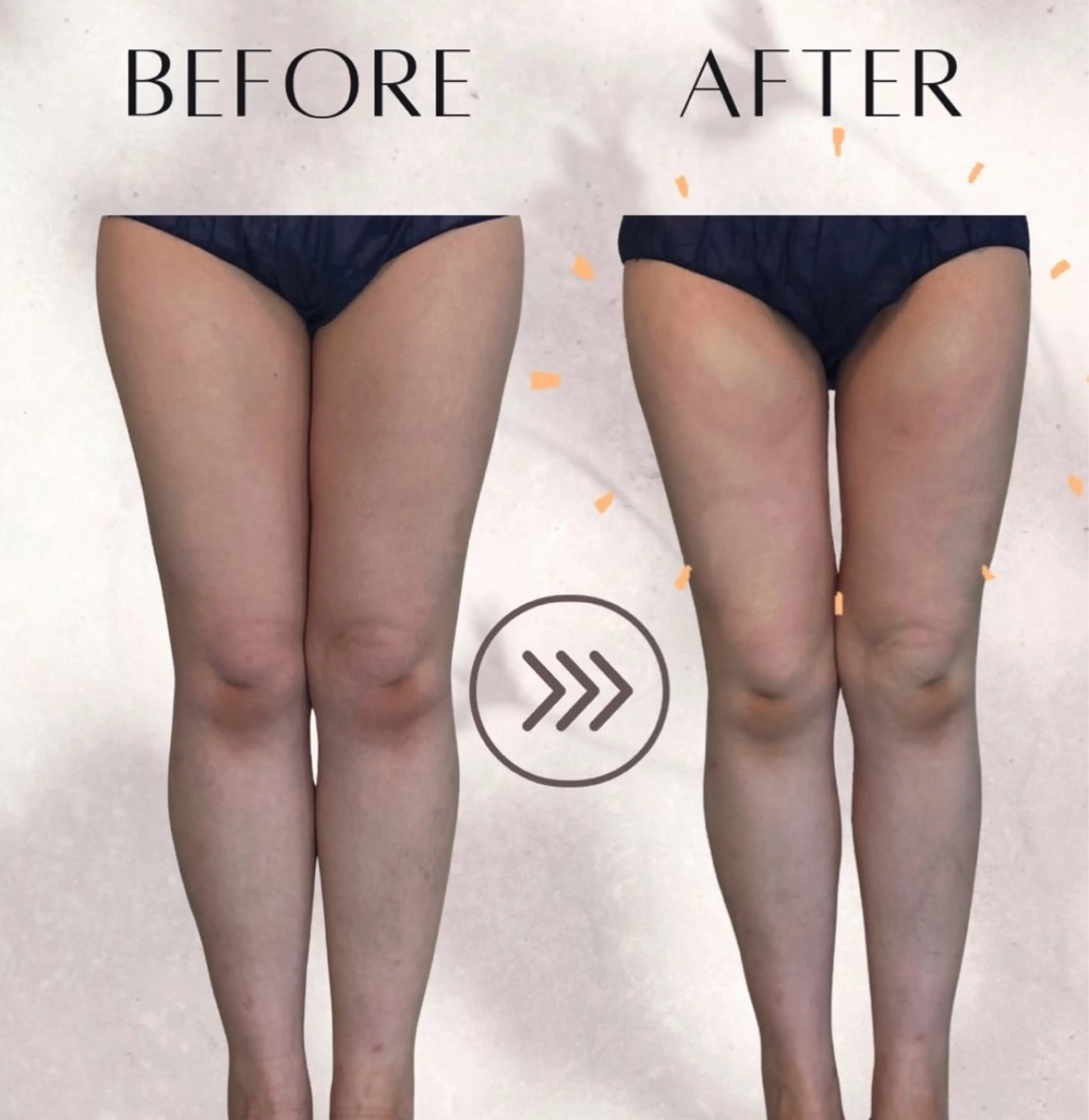 エステ 綺麗のひみつ グランプリ受賞店のエステ・リラクイメージ