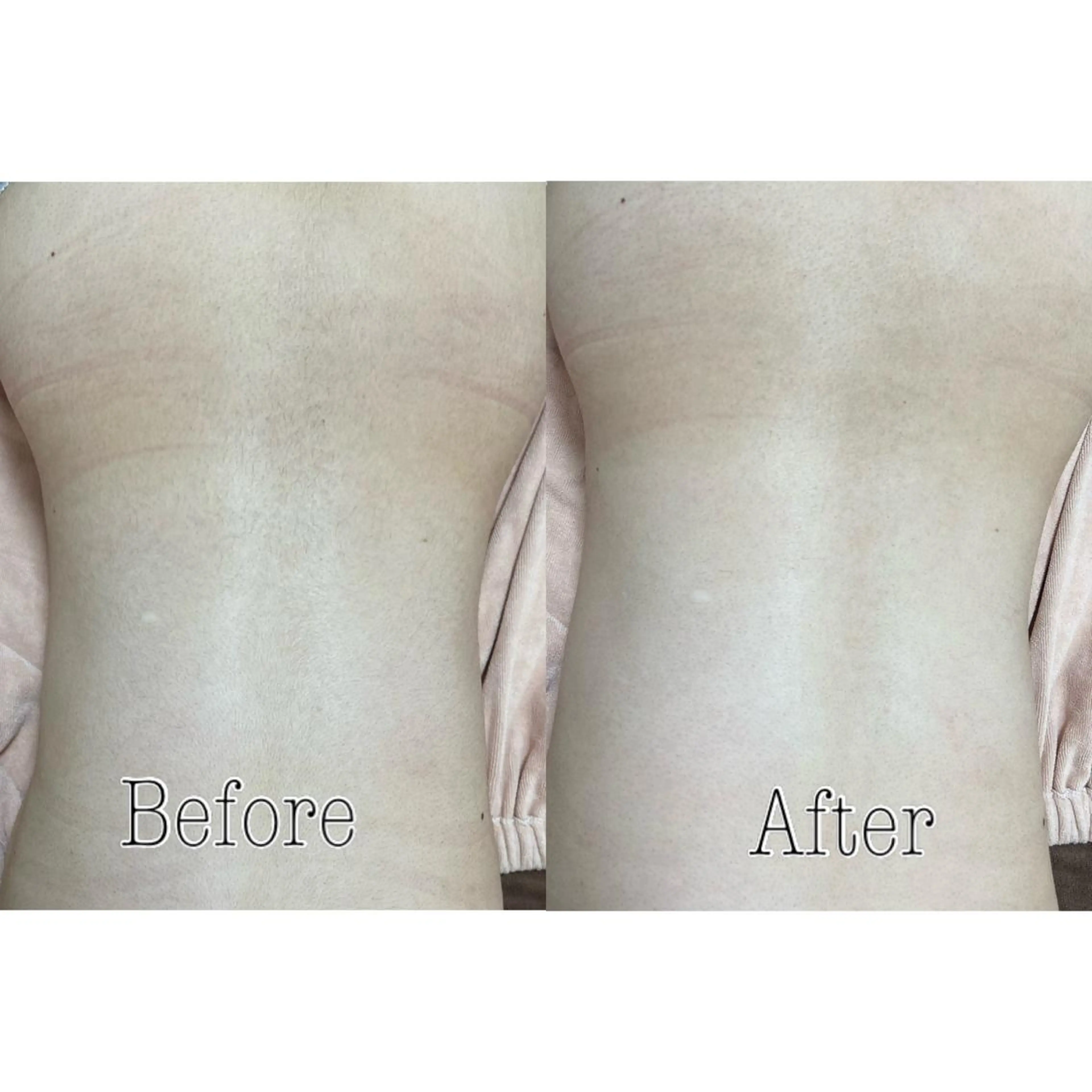 都度払い制脱毛サロンBe Charm所属・Be Charm 山﨑のエステ・リラクイメージ