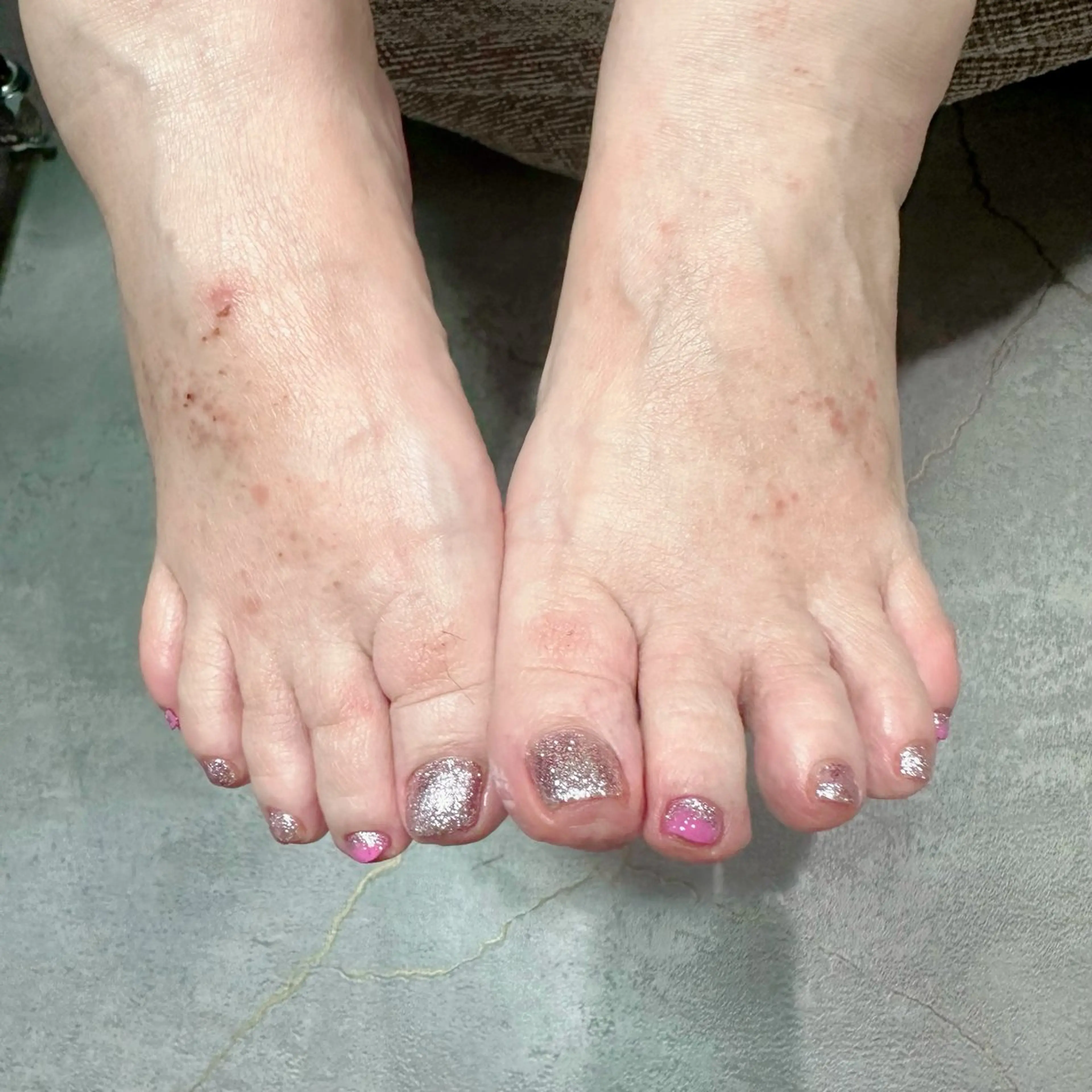 ネイル キラキラネイル ラメ(グリッター) ピンク フットネイル atelier salon Mar’s鶴ヶ島 アットホームサロン所属・a Tomokaのネイルデザイン