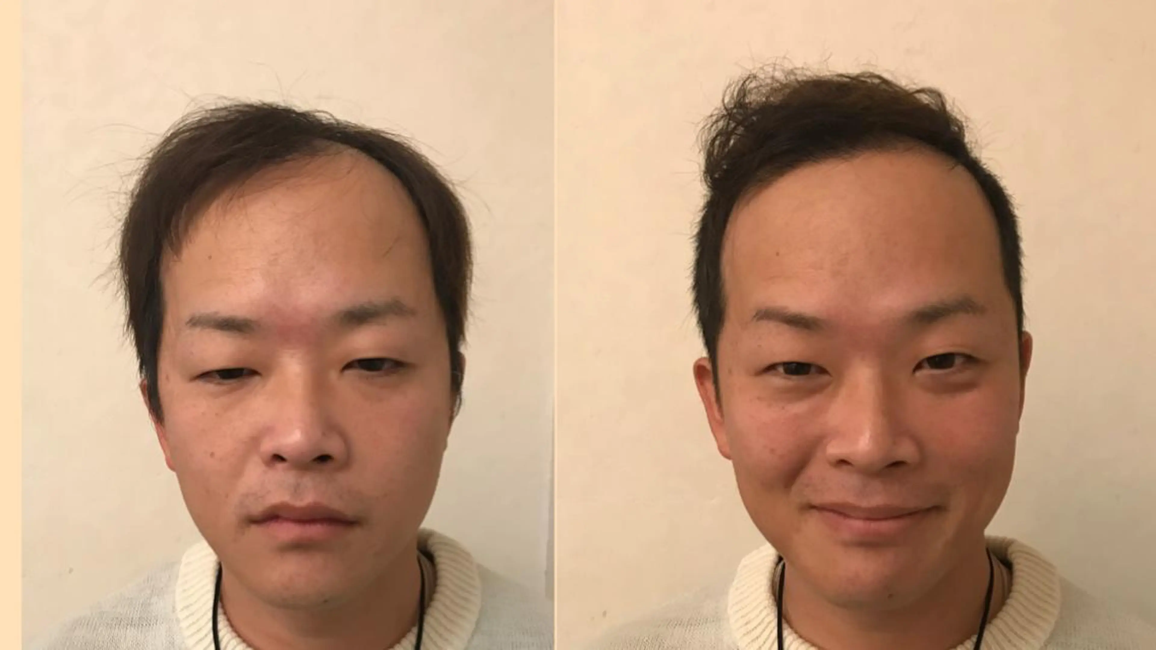 ショート パーマ メンズ hairstudio102所属・YouTube 出演募集のその他イメージ