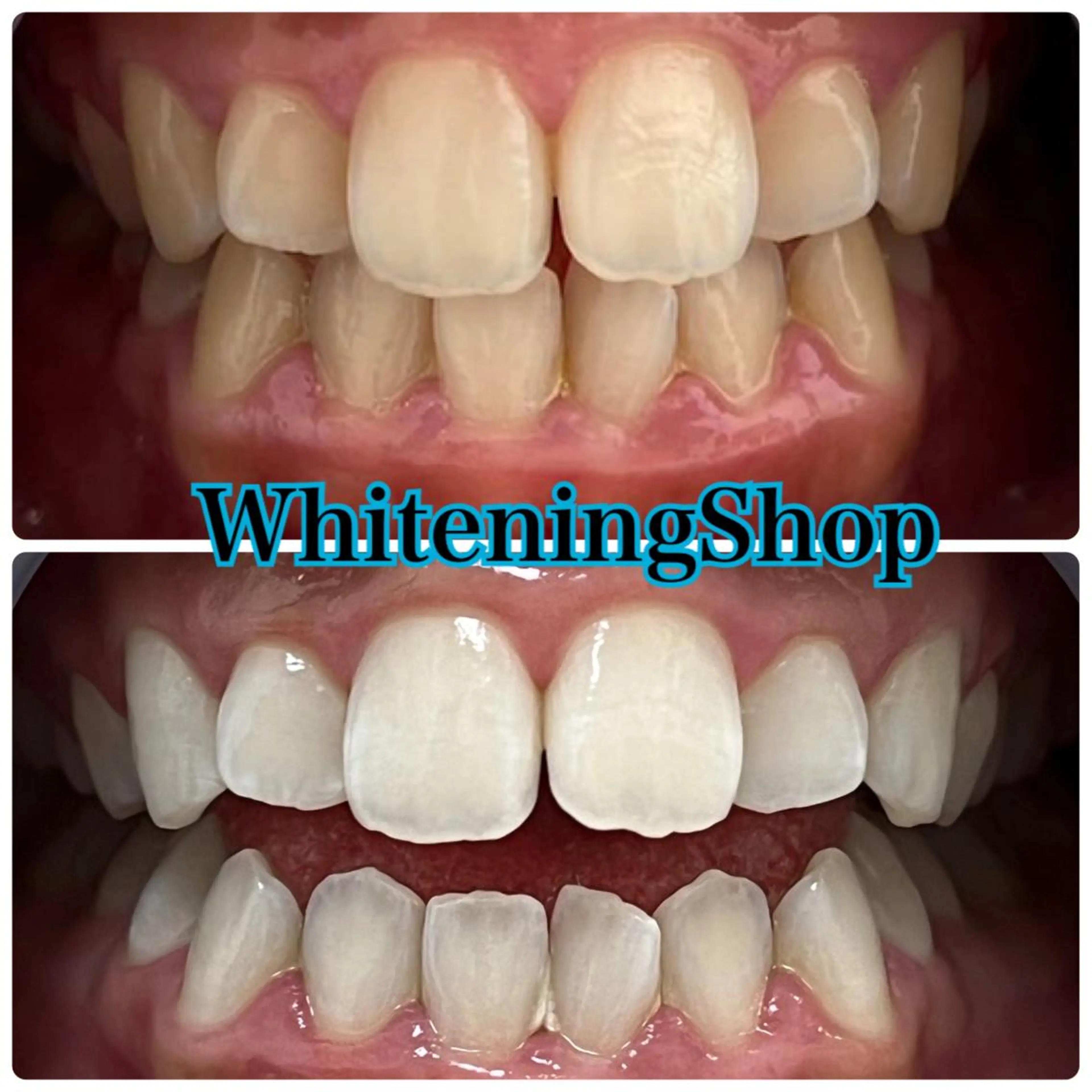 ホワイトニング ショップ吉祥寺店のエステ・リラクイメージ