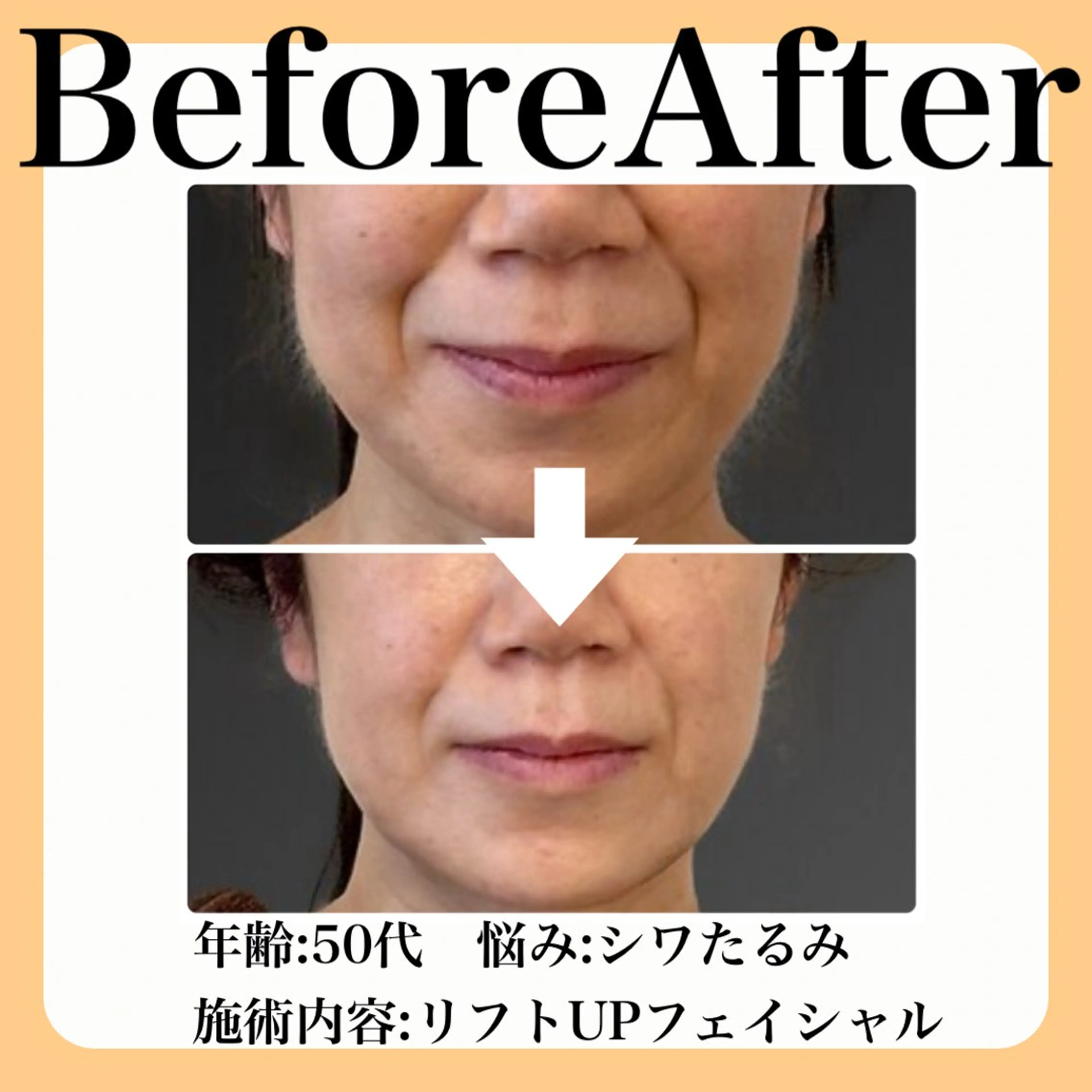 エステ 毛穴・たるみ･ニキビケア専門サロンsui所属・sui【スイ】 ARISAのエステ・リラクイメージ