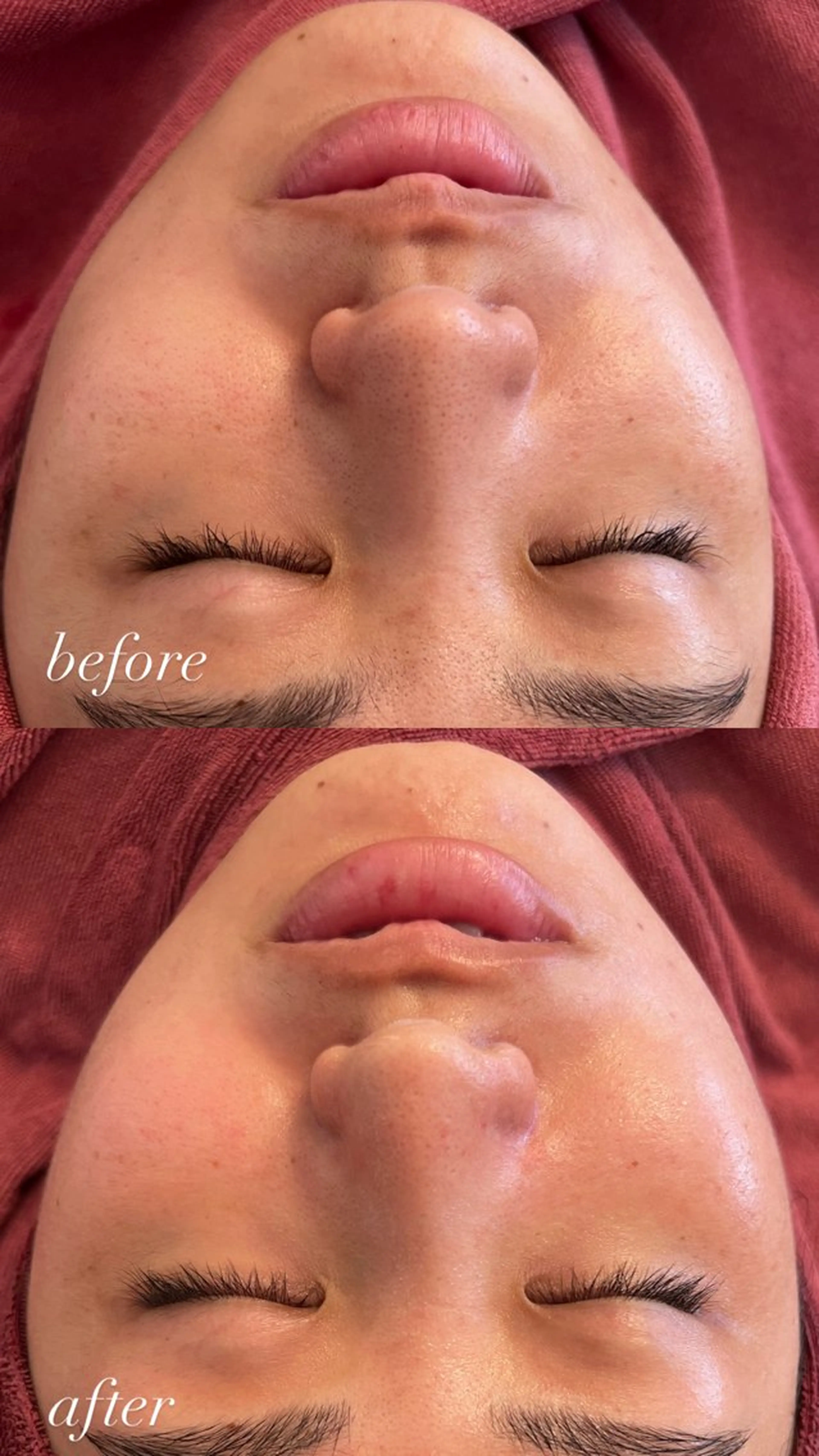 肌管理サロン neoriiのその他イメージ