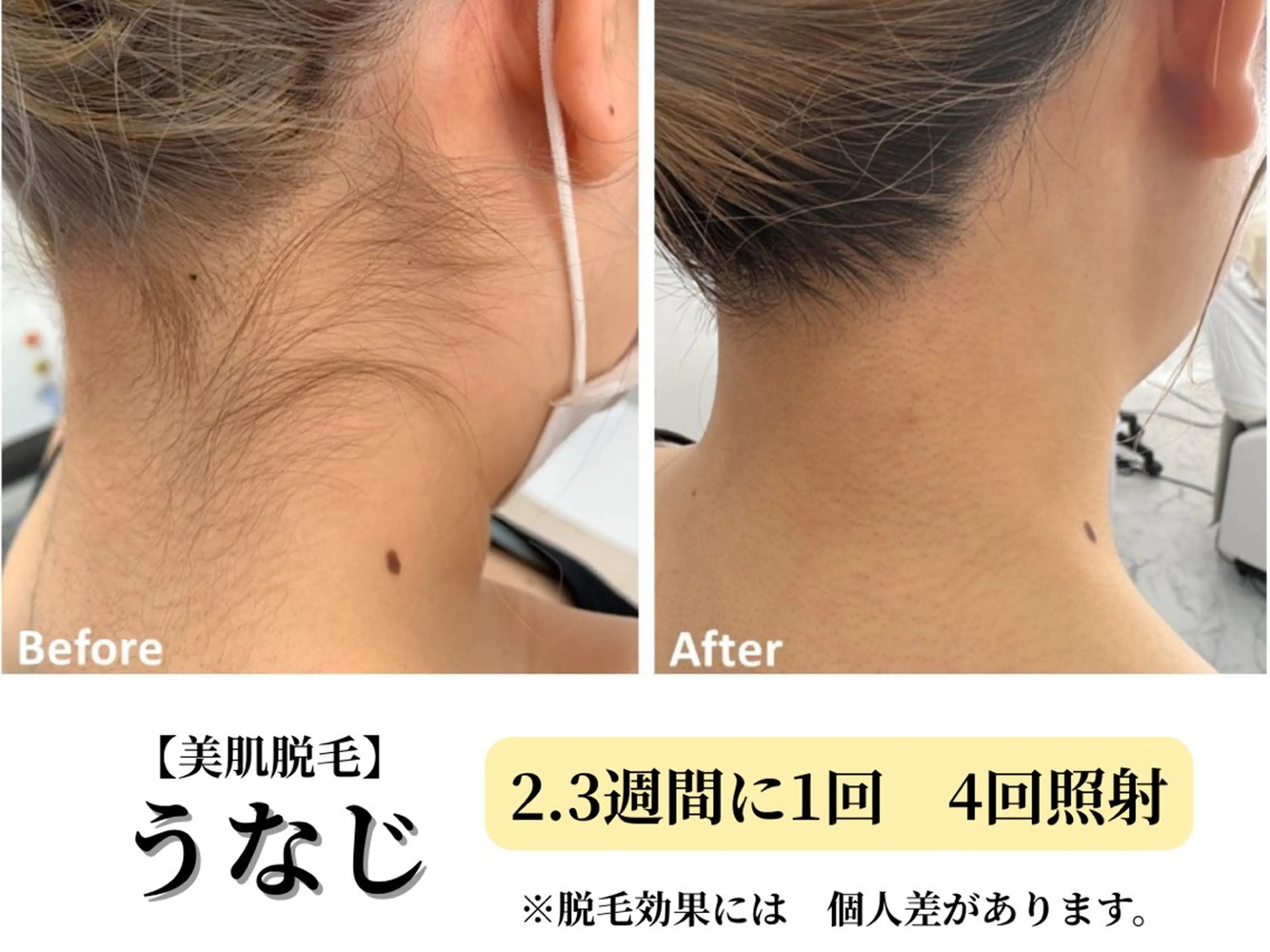 脱毛 Belle White所属・本格痩身＊肌質改善＊ BelleWhiteのエステ・リラクイメージ