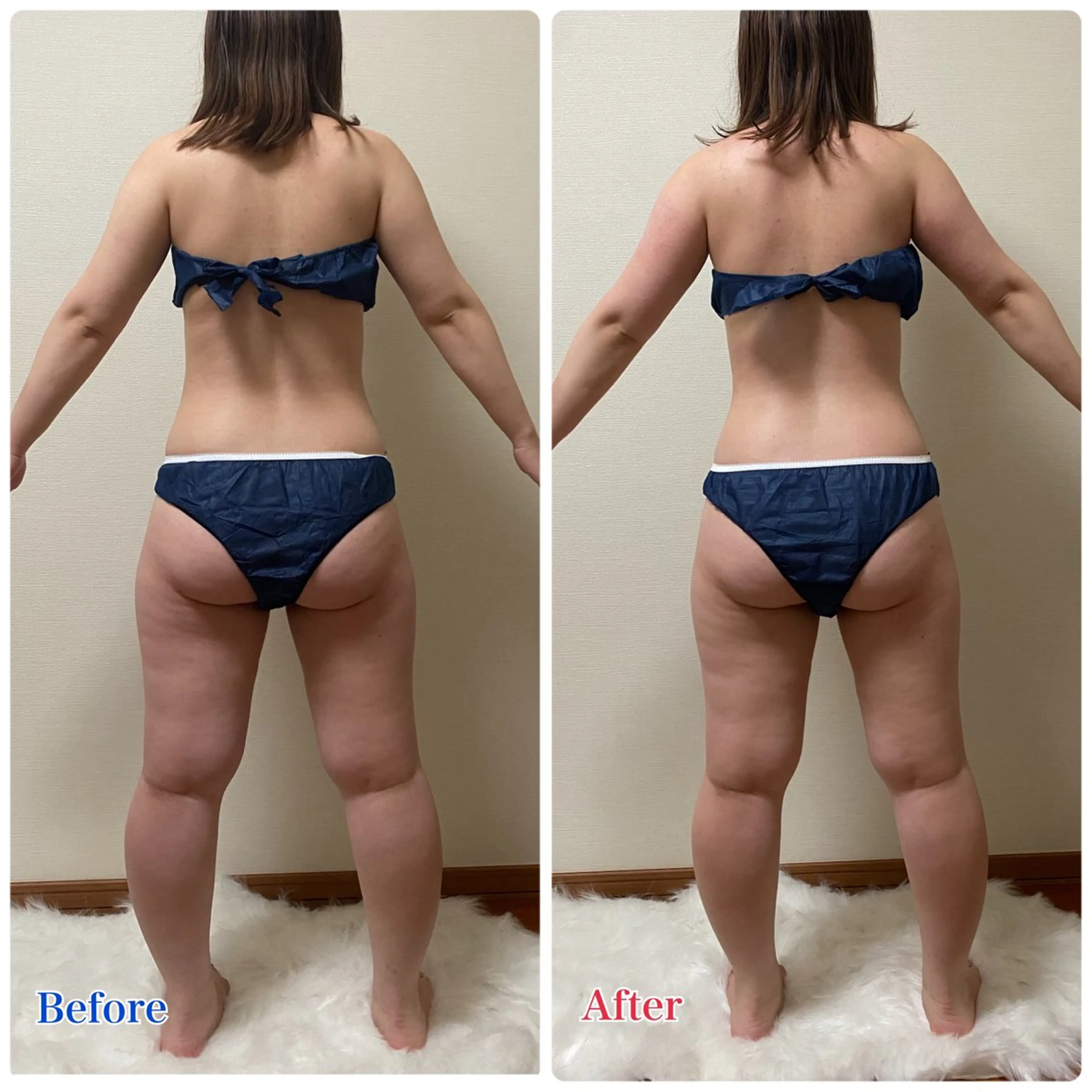 エステ ACORAL痩身 NAZUKIのエステ・リラクイメージ