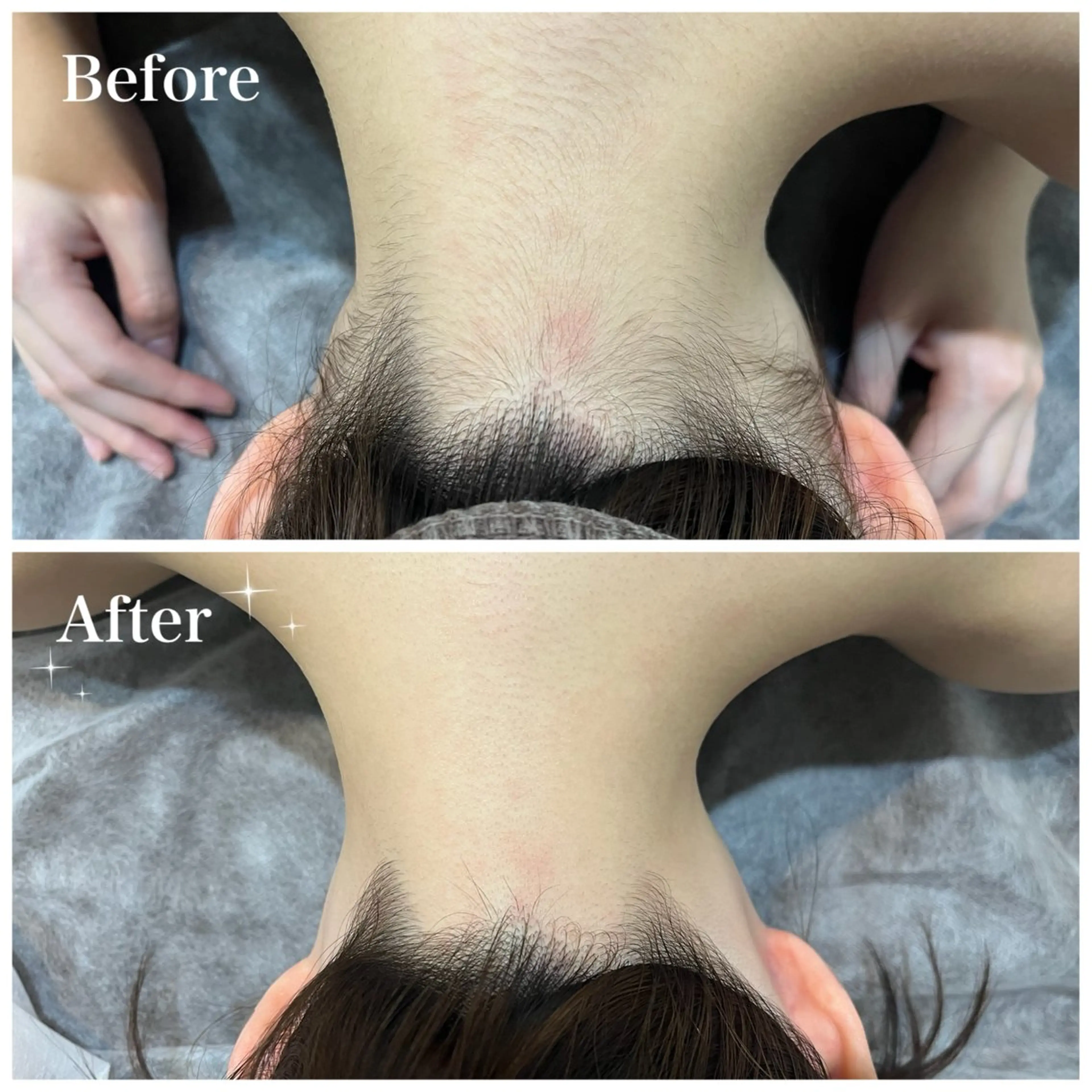 脱毛 脱毛サロン fam.豊澤柚良のエステ・リラクイメージ