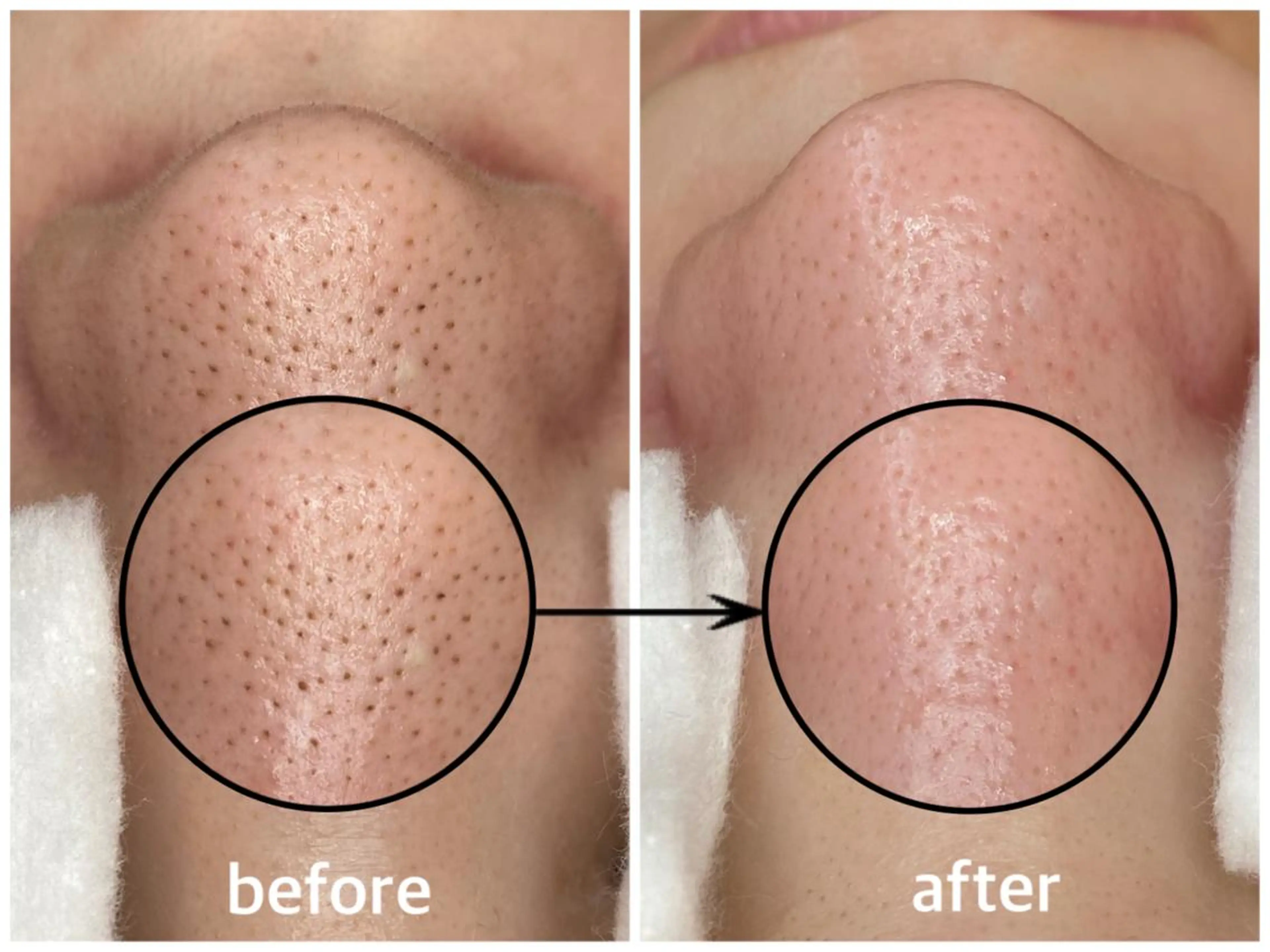 エステ リラク 韓国肌管理 【毛穴専科】のエステ・リラクイメージ