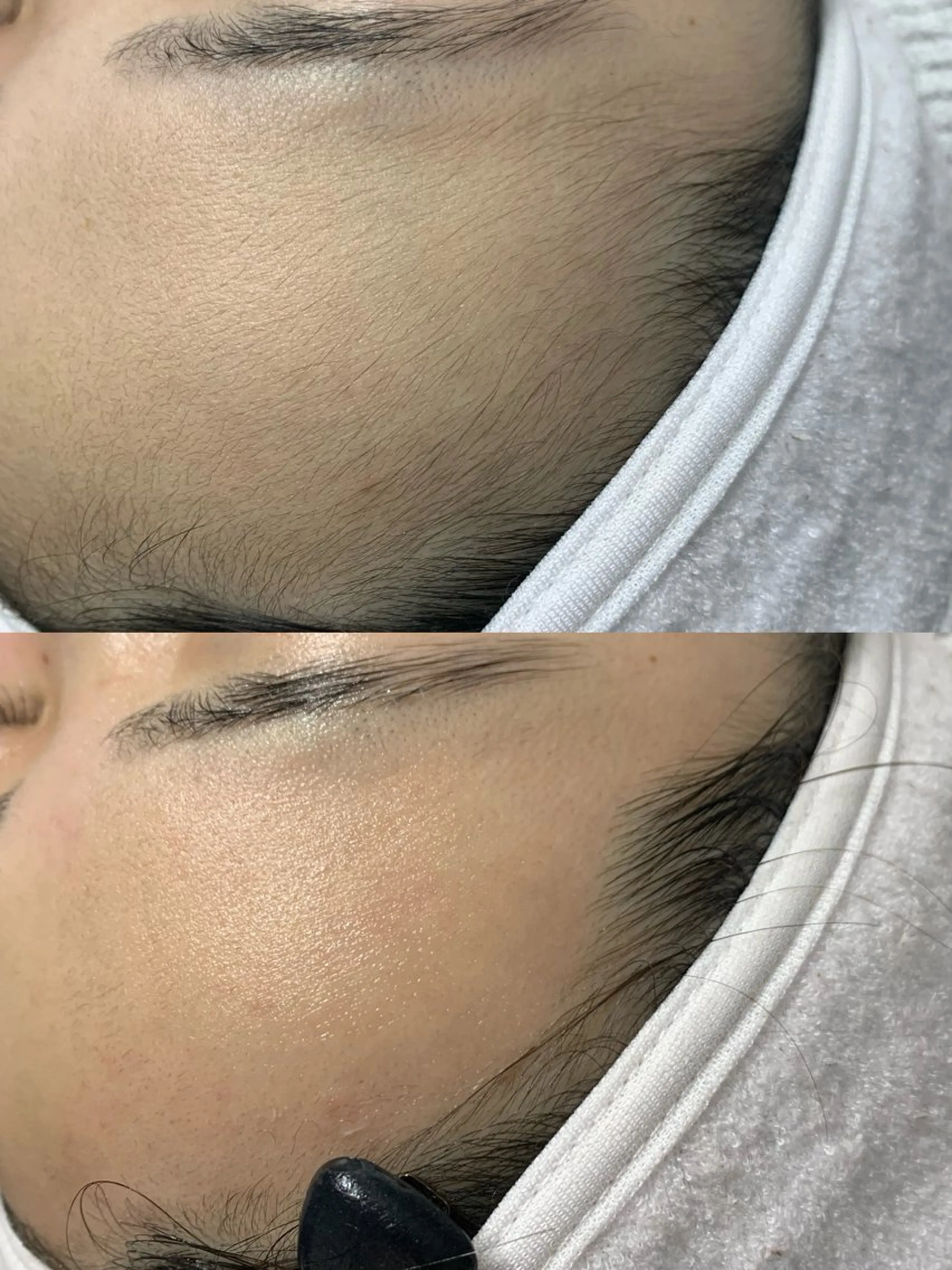 【つるんとたまご肌に感動！】美肌フェイスワックス（保湿ケア付き）の写真