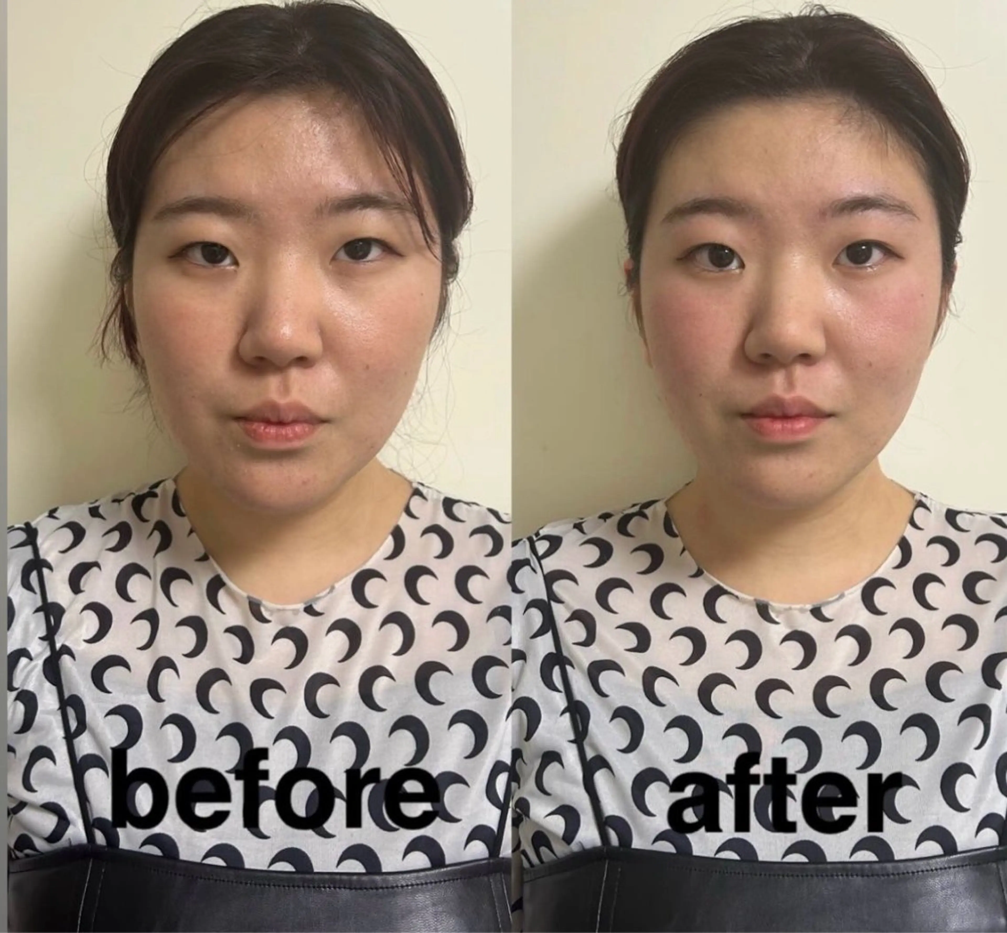 エステ リラク 美容鍼灸サロン mahoroba院長のエステ・リラクイメージ