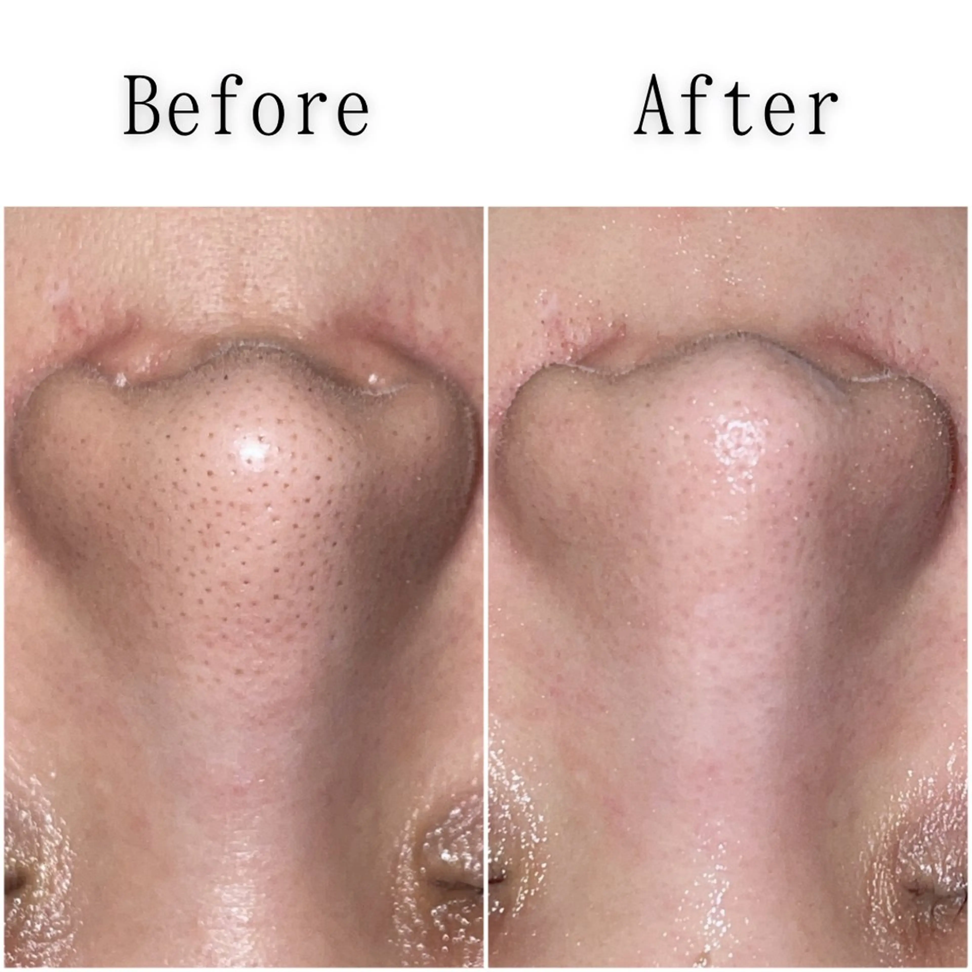 エステ SELF  BEAUTY gracia浦添店所属・gracia 浦添店のその他イメージ