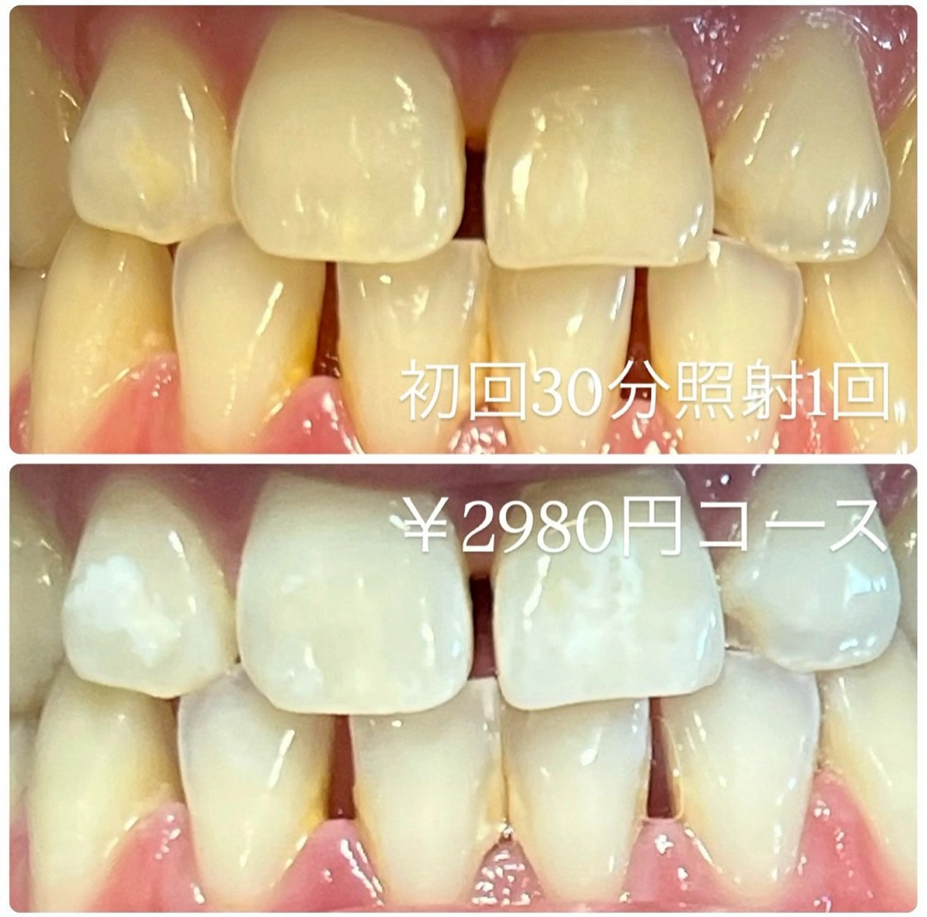 その他 PLATINUM Beauty 横浜店所属・ホワイトニングルーム 横浜店のその他イメージ