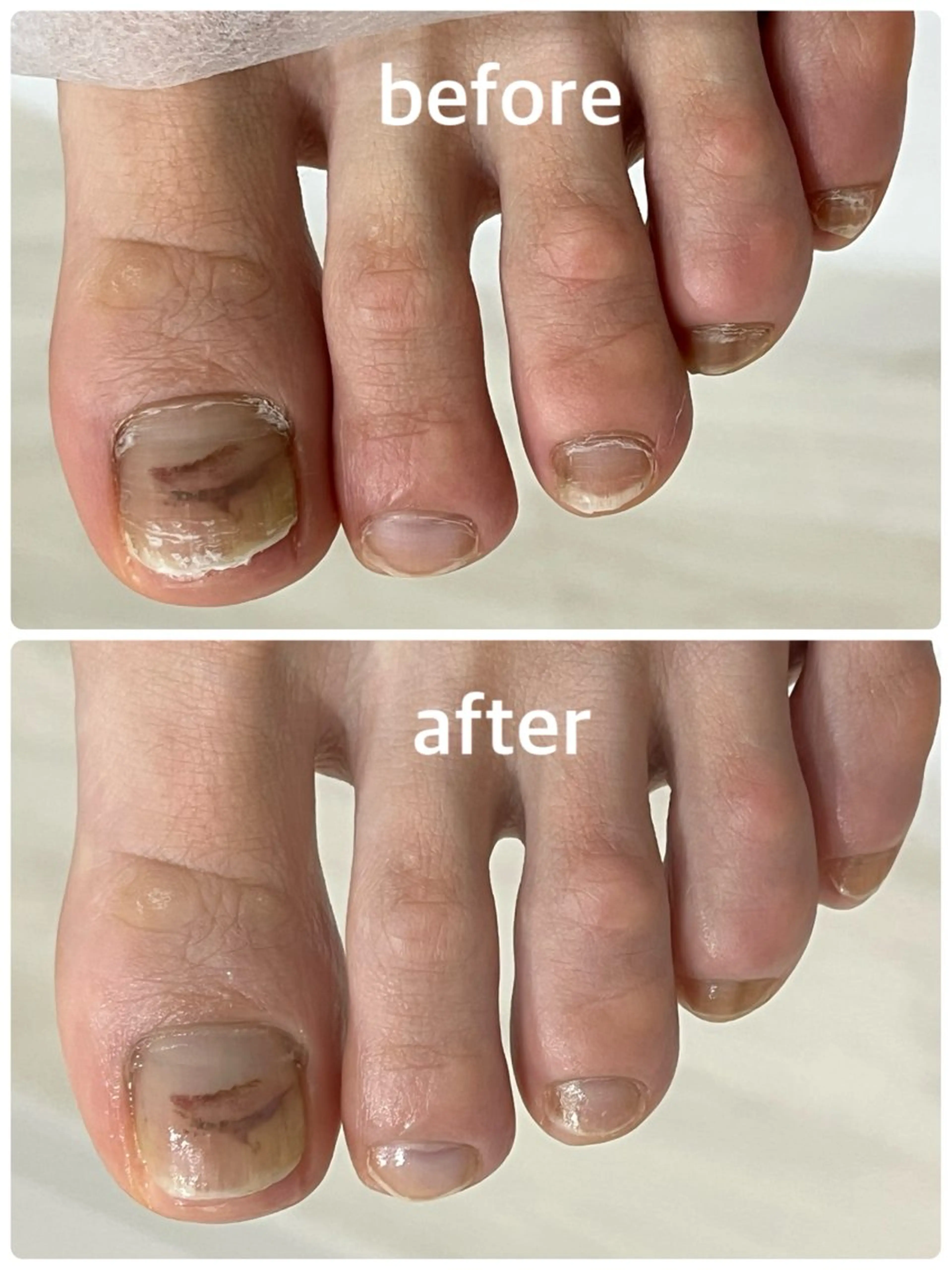 ネイル フットネイル フットネイル 足・爪トラブル専門店　foot grace所属・加藤 望のネイルデザイン