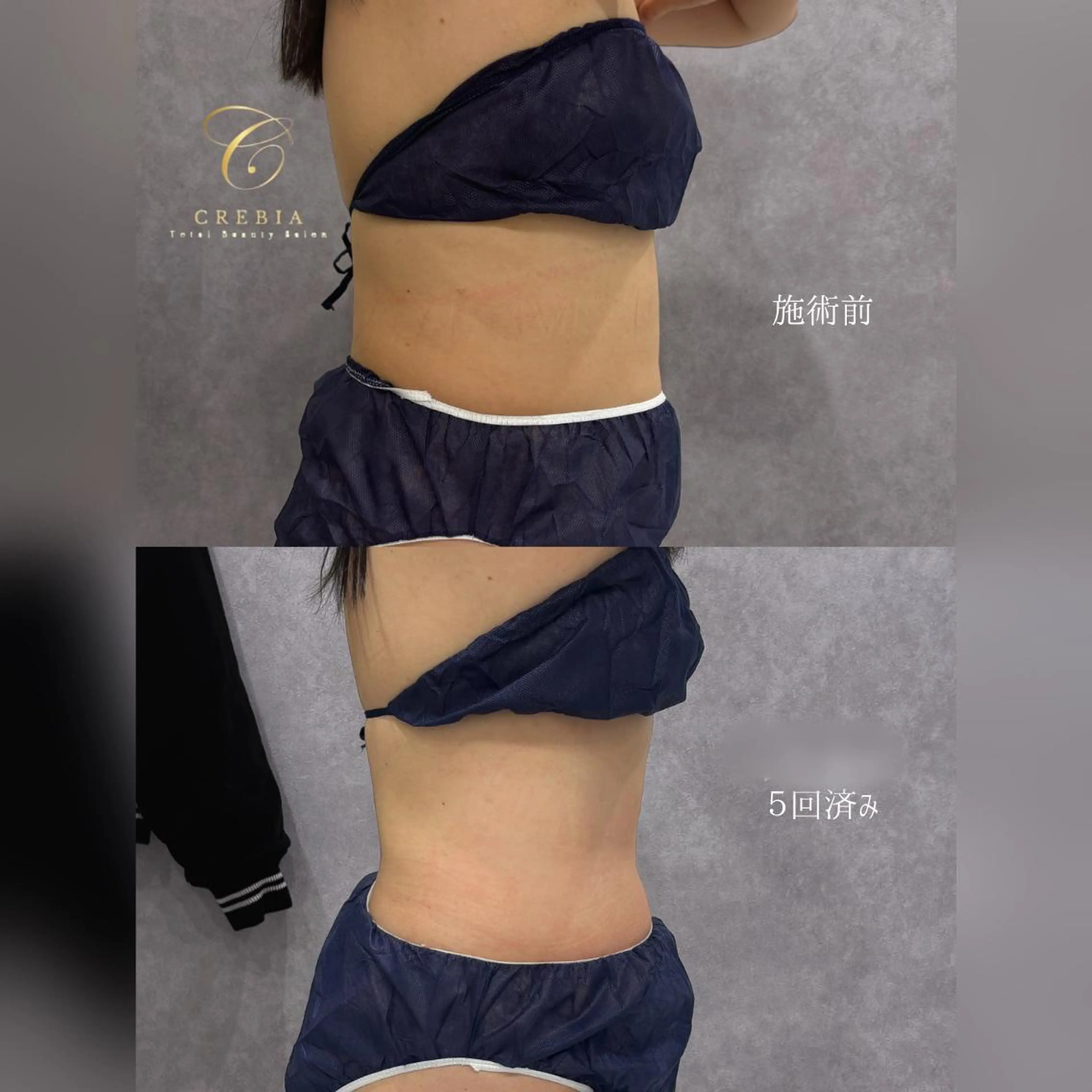 心斎橋🤍堀江.小顔 ハーブ.痩身クレビアのエステ・リラクイメージ