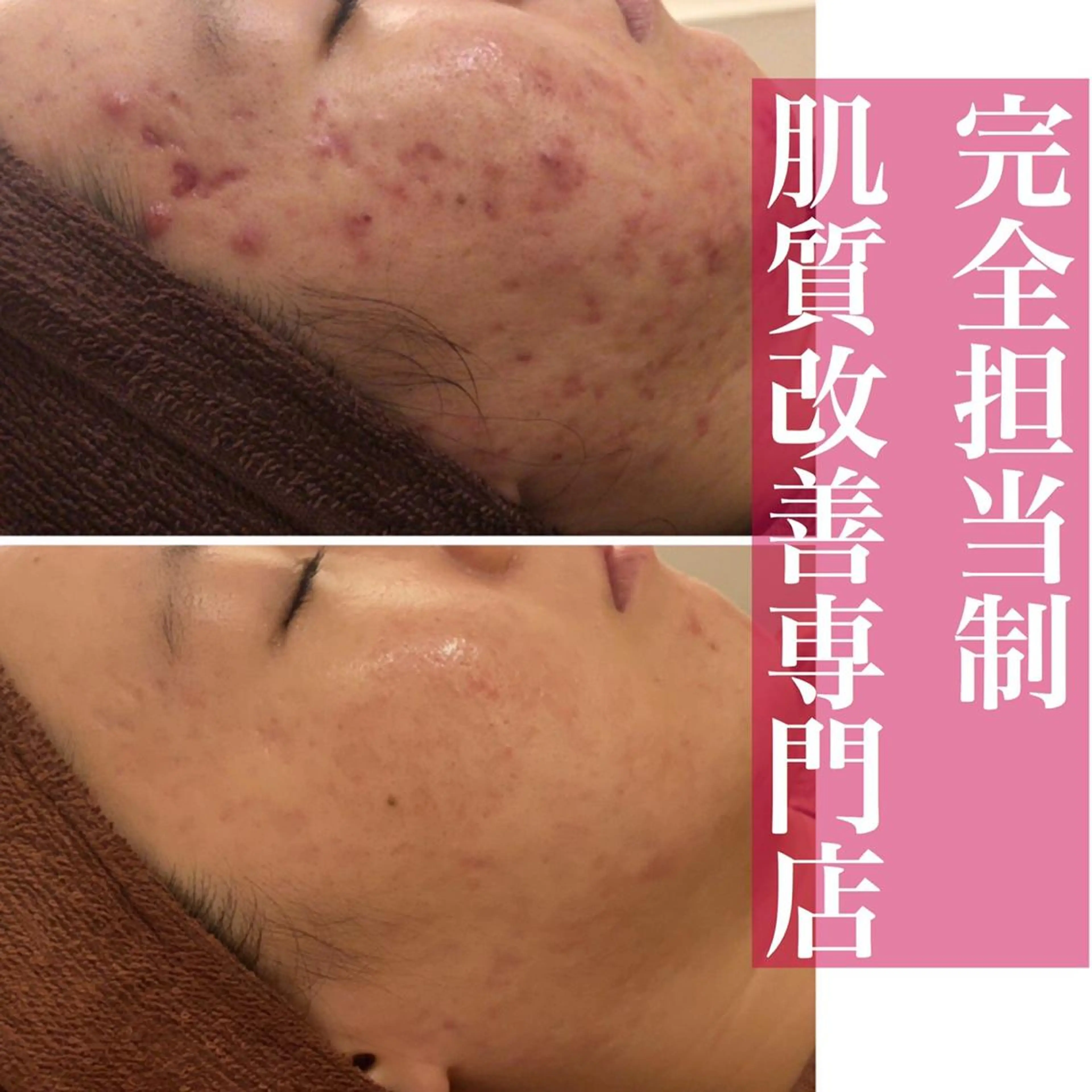 ミディアム カラー パーマ ヘアアレンジ メンズ キッズ ネイル マツエク・マツパ エステ リラク ニキビ・肌質改善専門 ♡人生が変わるサロンのエステ・リラクイメージ