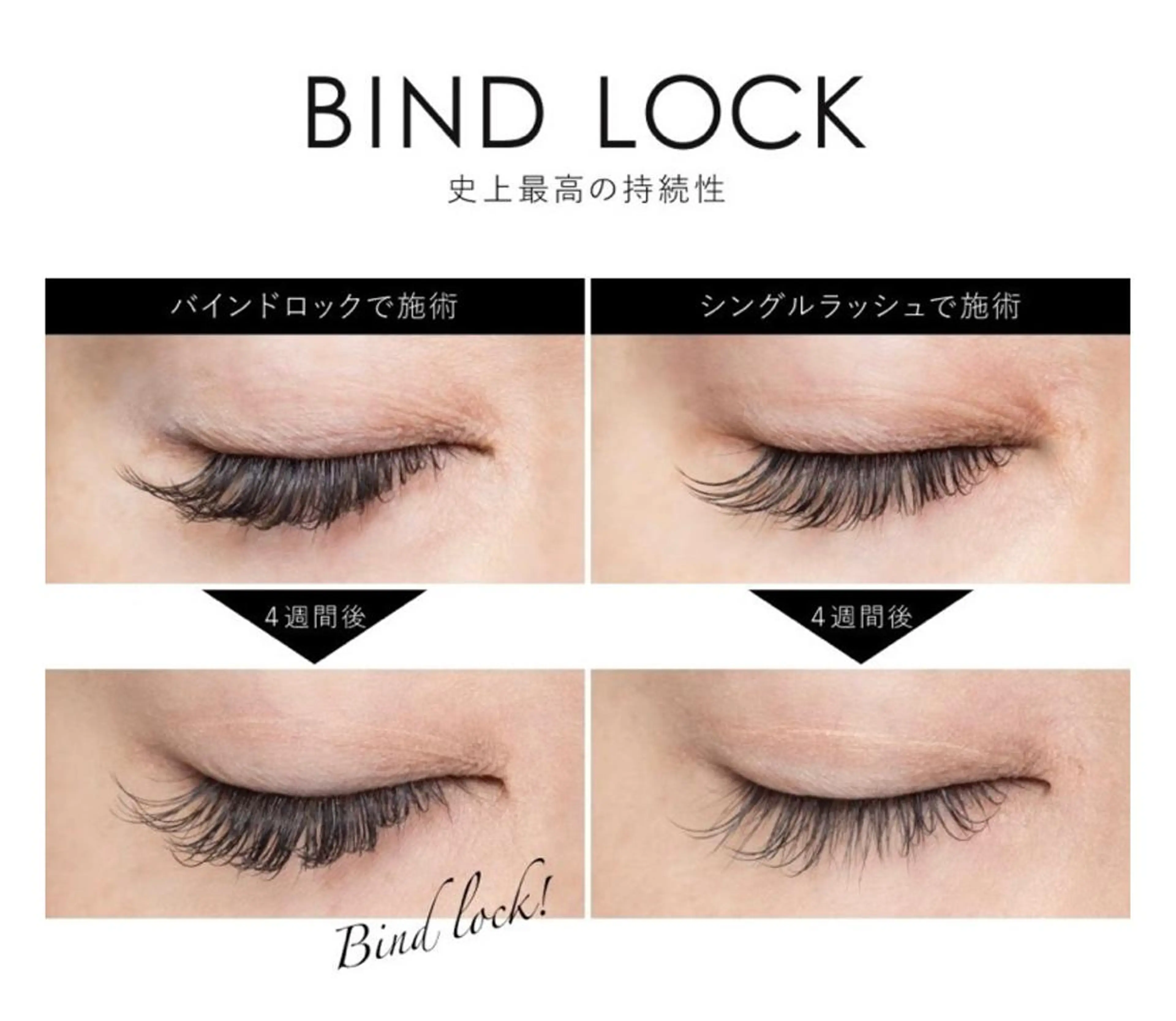 《史上最高の持続力💗》バインドロック 100束の写真