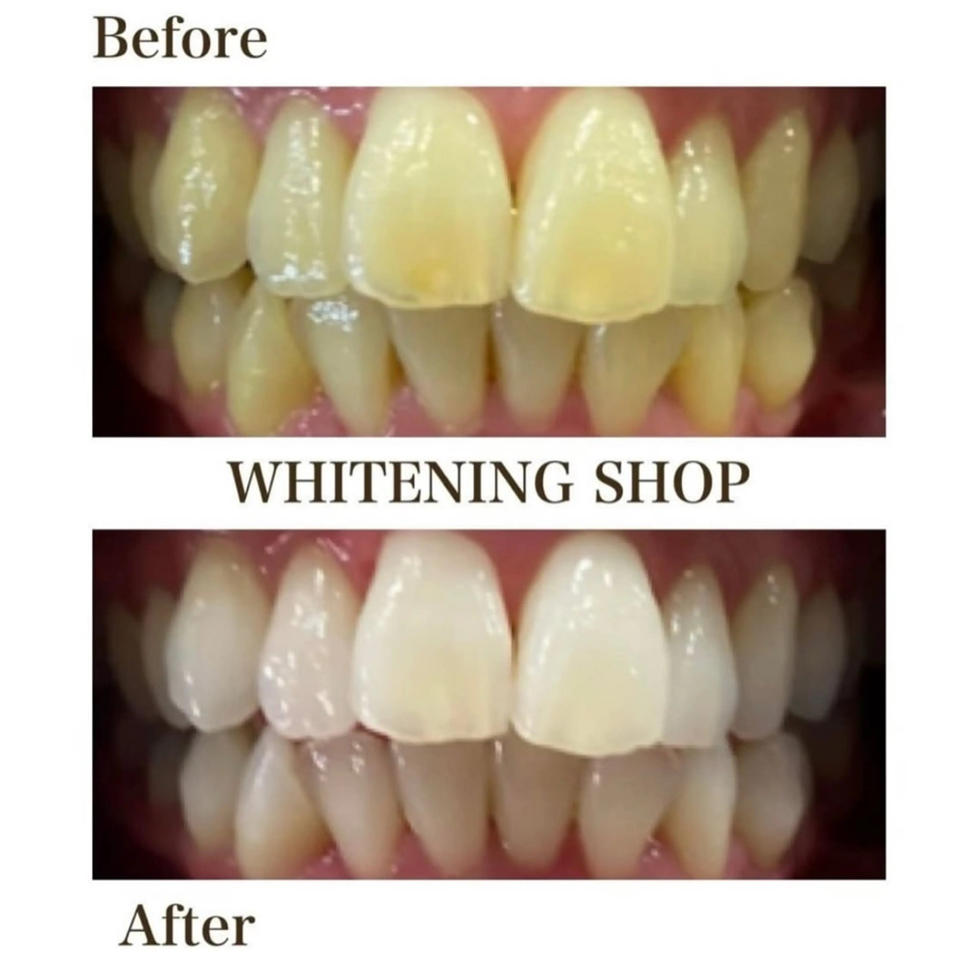 ホワイトニングショップ伊丹店所属・ホワイトニング ショップ伊丹店のその他イメージ