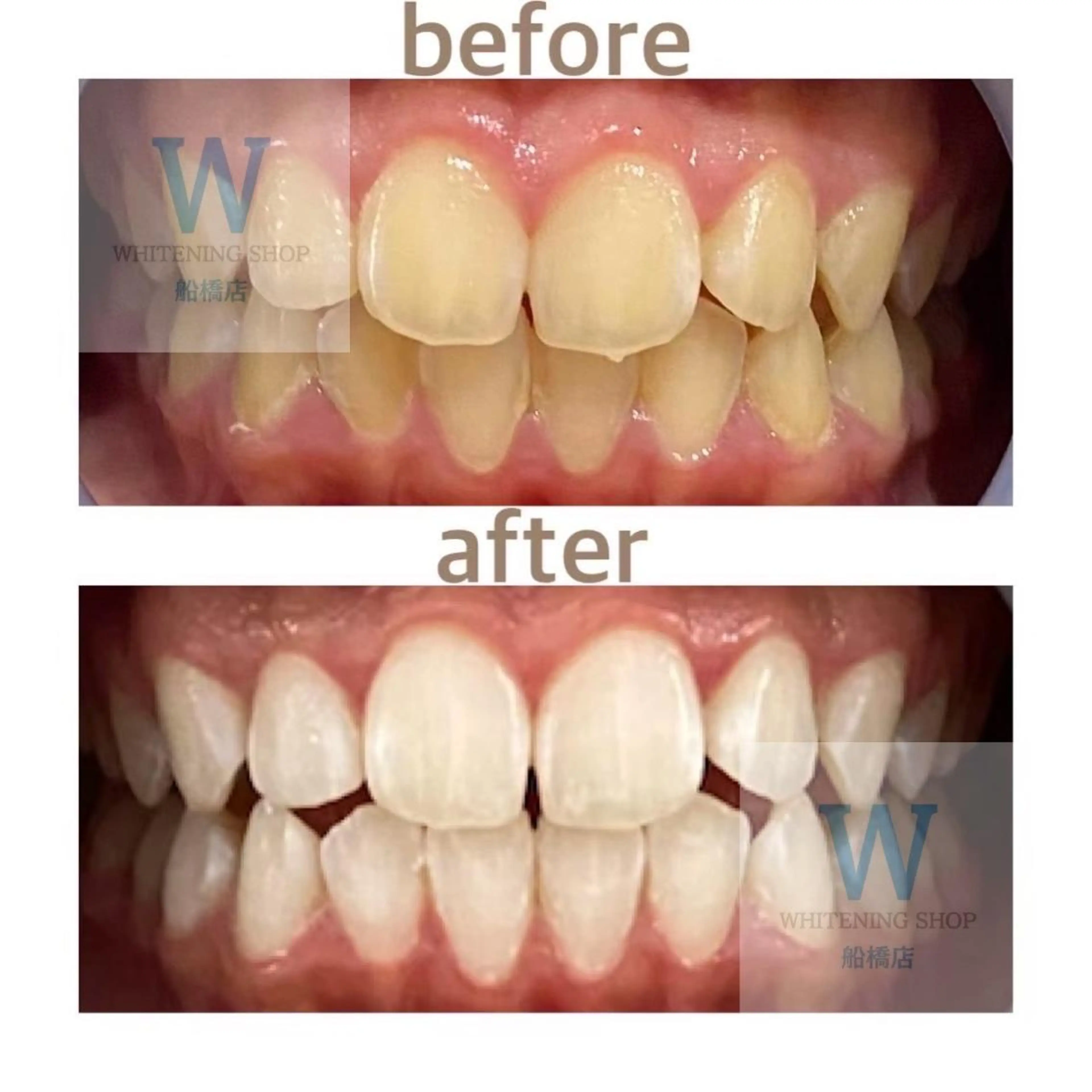 ホワイトニング ショップ船橋２号店のエステ・リラクイメージ