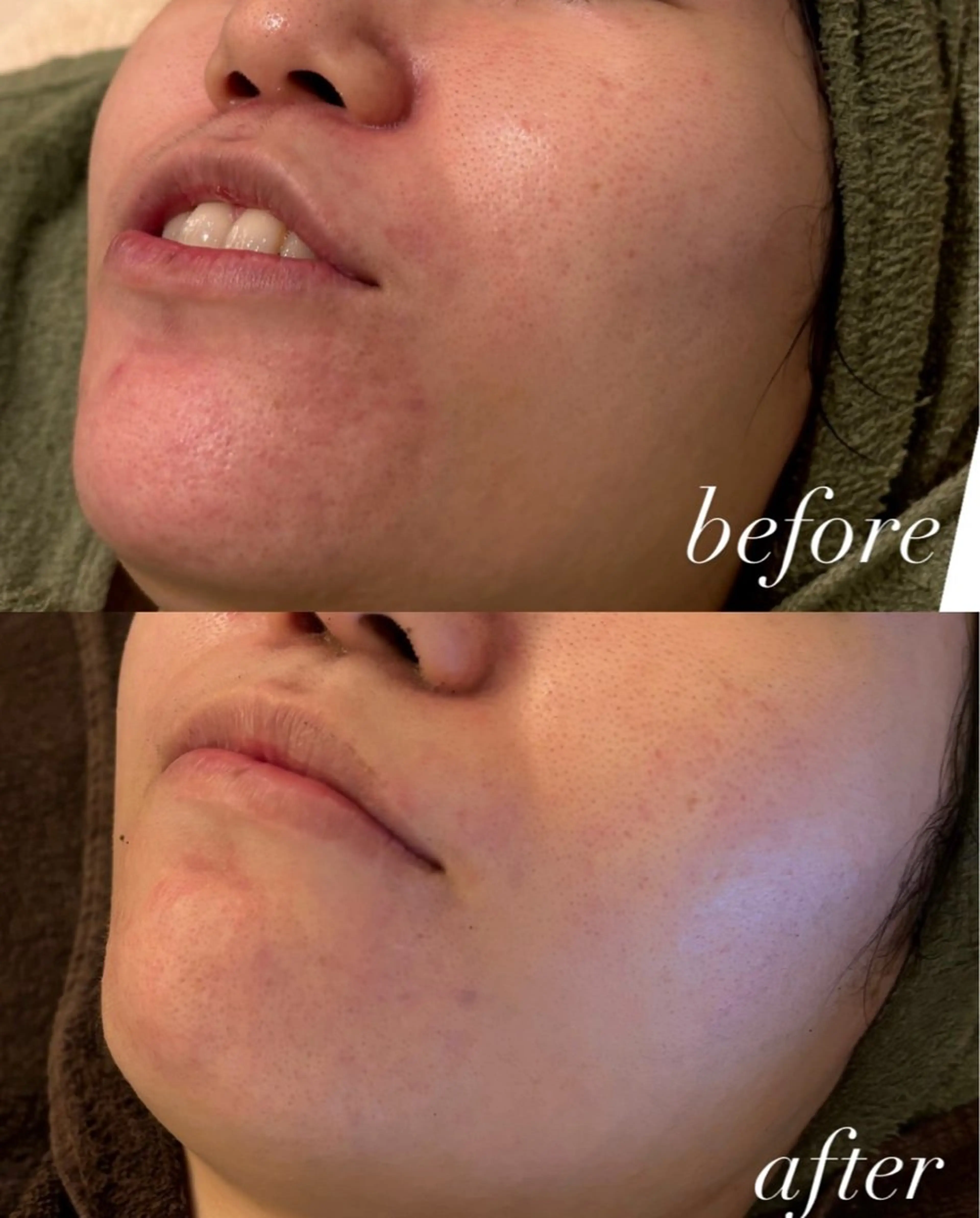 Ellebeauty relaxationのエステ・リラクイメージ