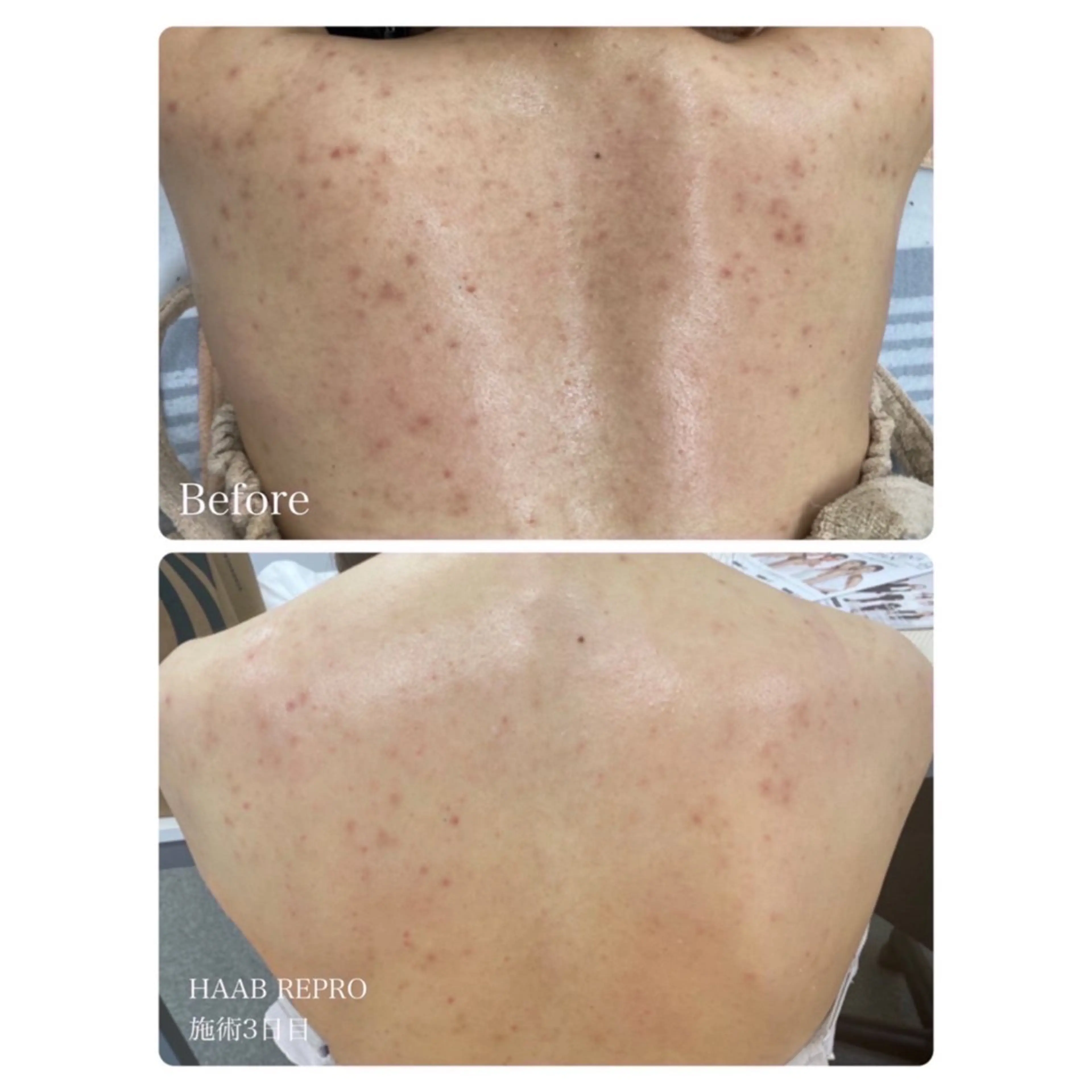 エステ 肌管理サロン neoriiのその他イメージ