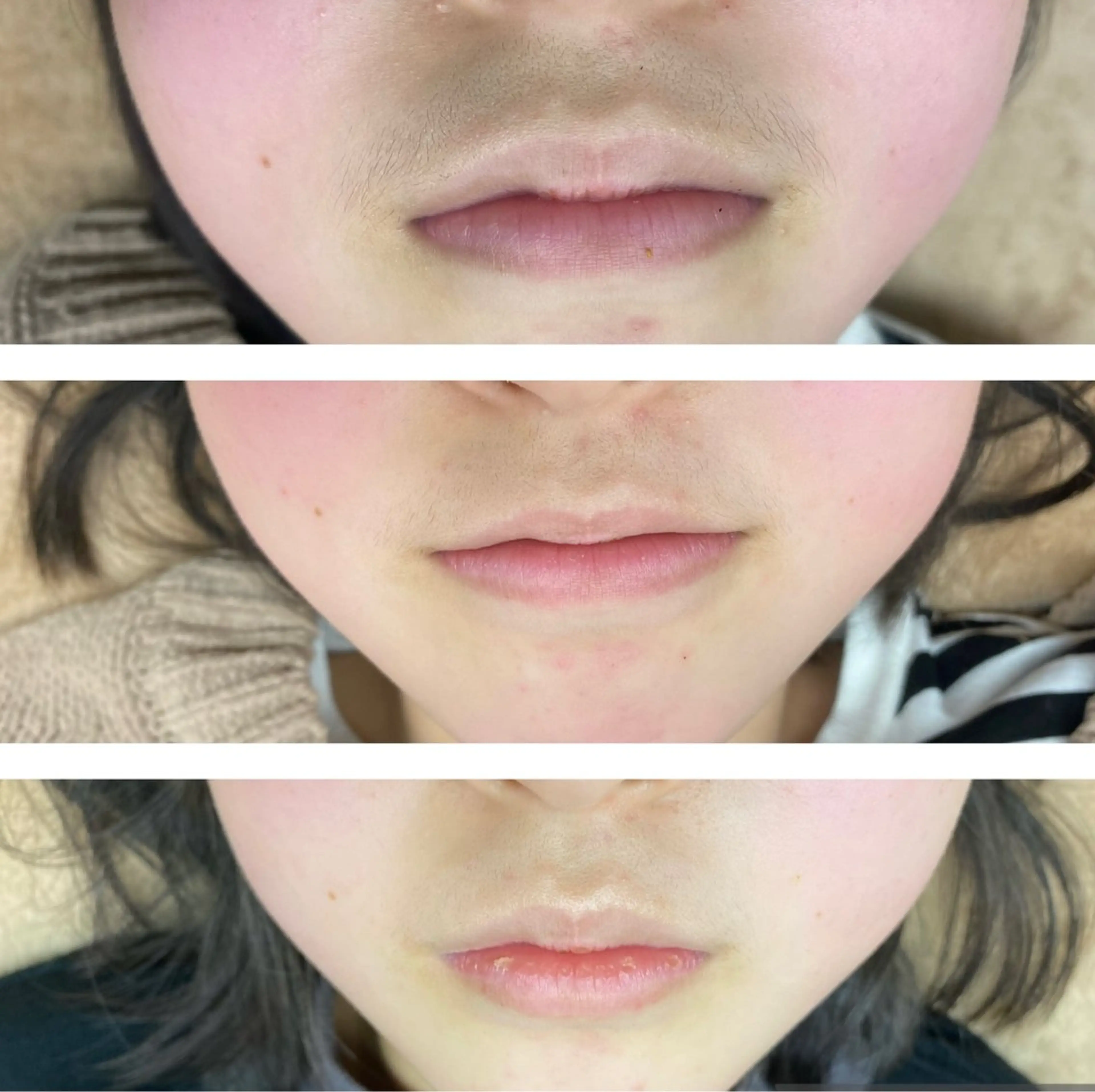 キッズ RE:moom リムーム/脱毛エステのエステ・リラクイメージ