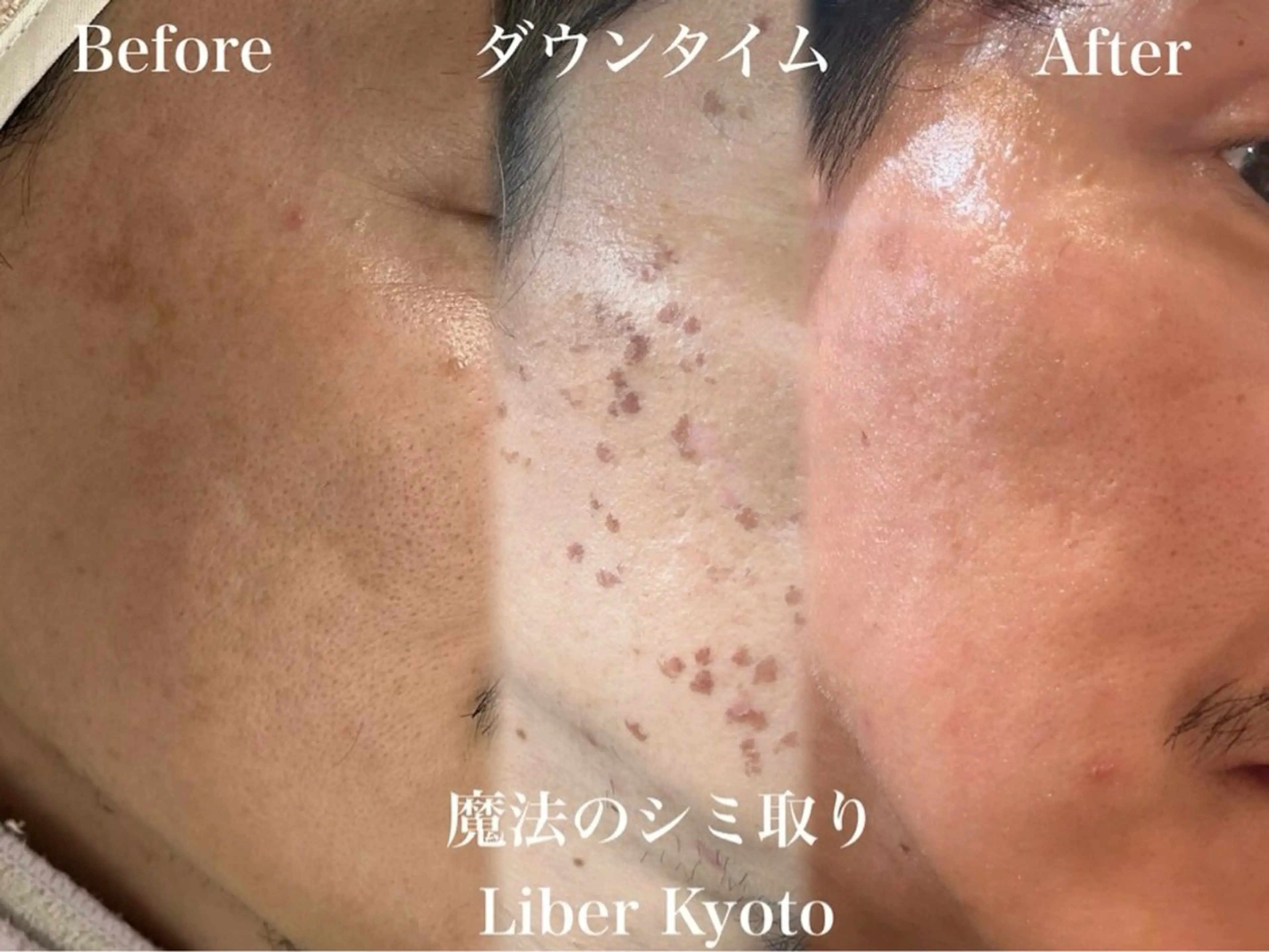 Liber Kyoto所属・魔法のシミ取り職人 CHIKAのエステ・リラクイメージ