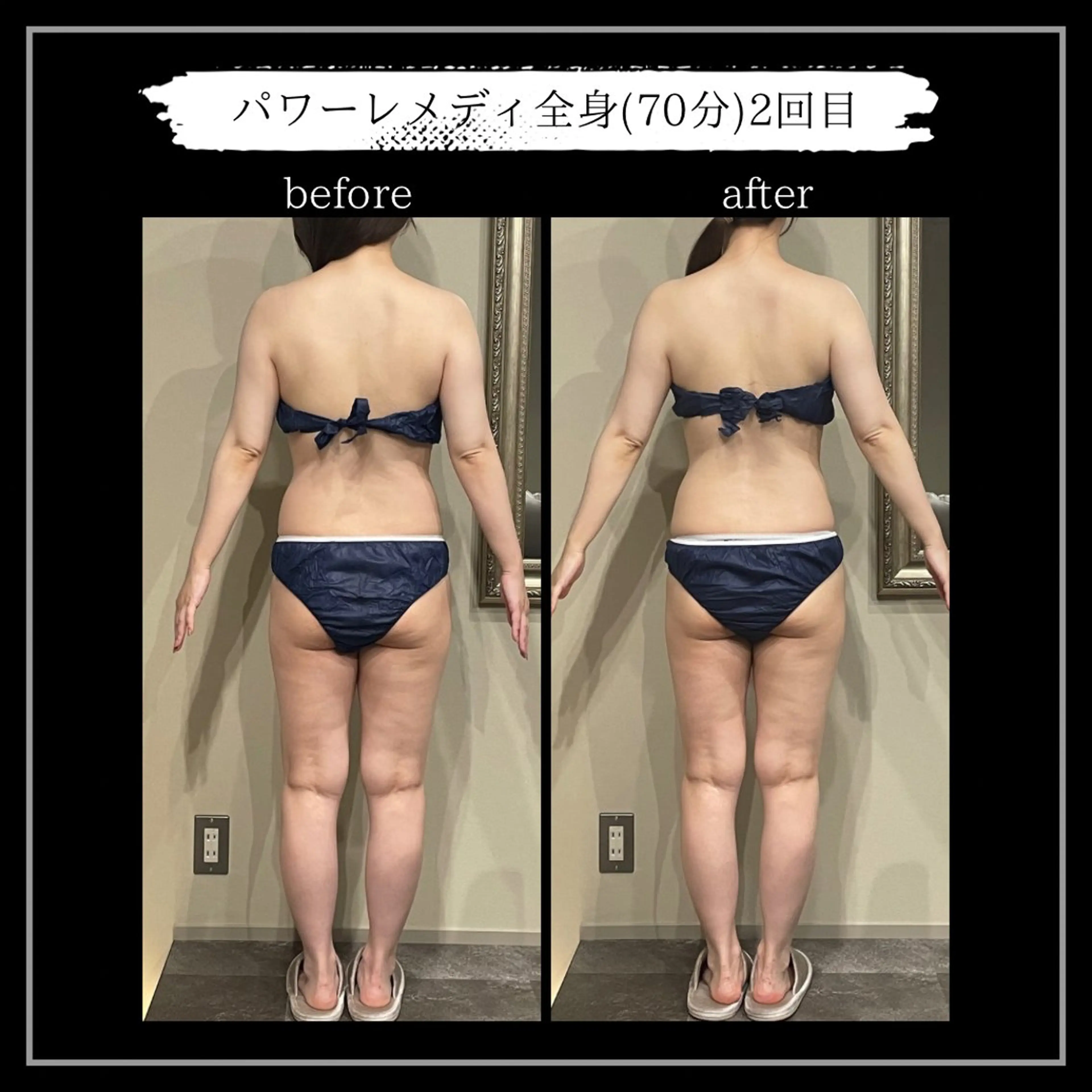 オフ:オン所属・オフ:オン 全身筋膜マッサージのエステ・リラクイメージ