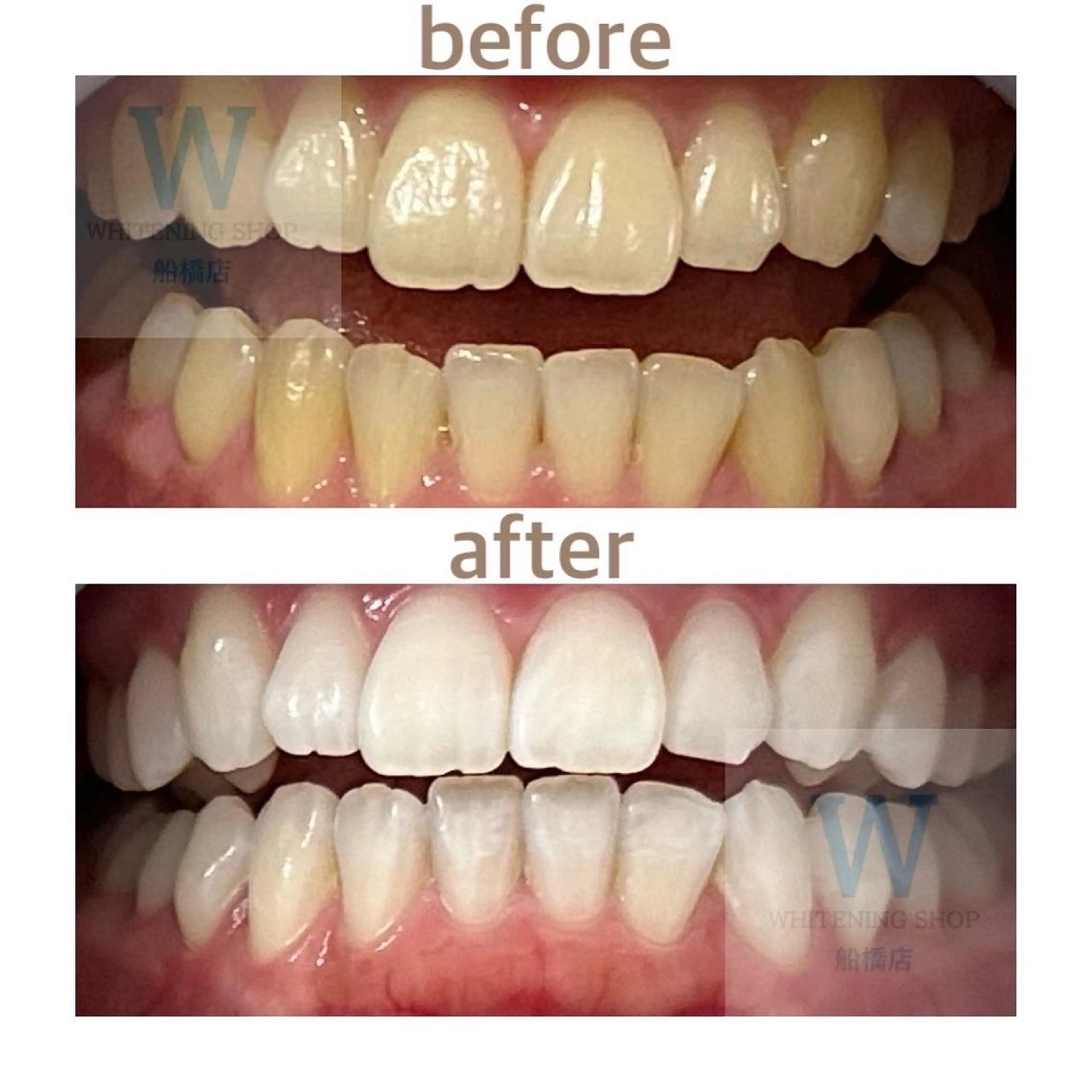 ホワイトニング ショップ船橋店🦷のエステ・リラクイメージ