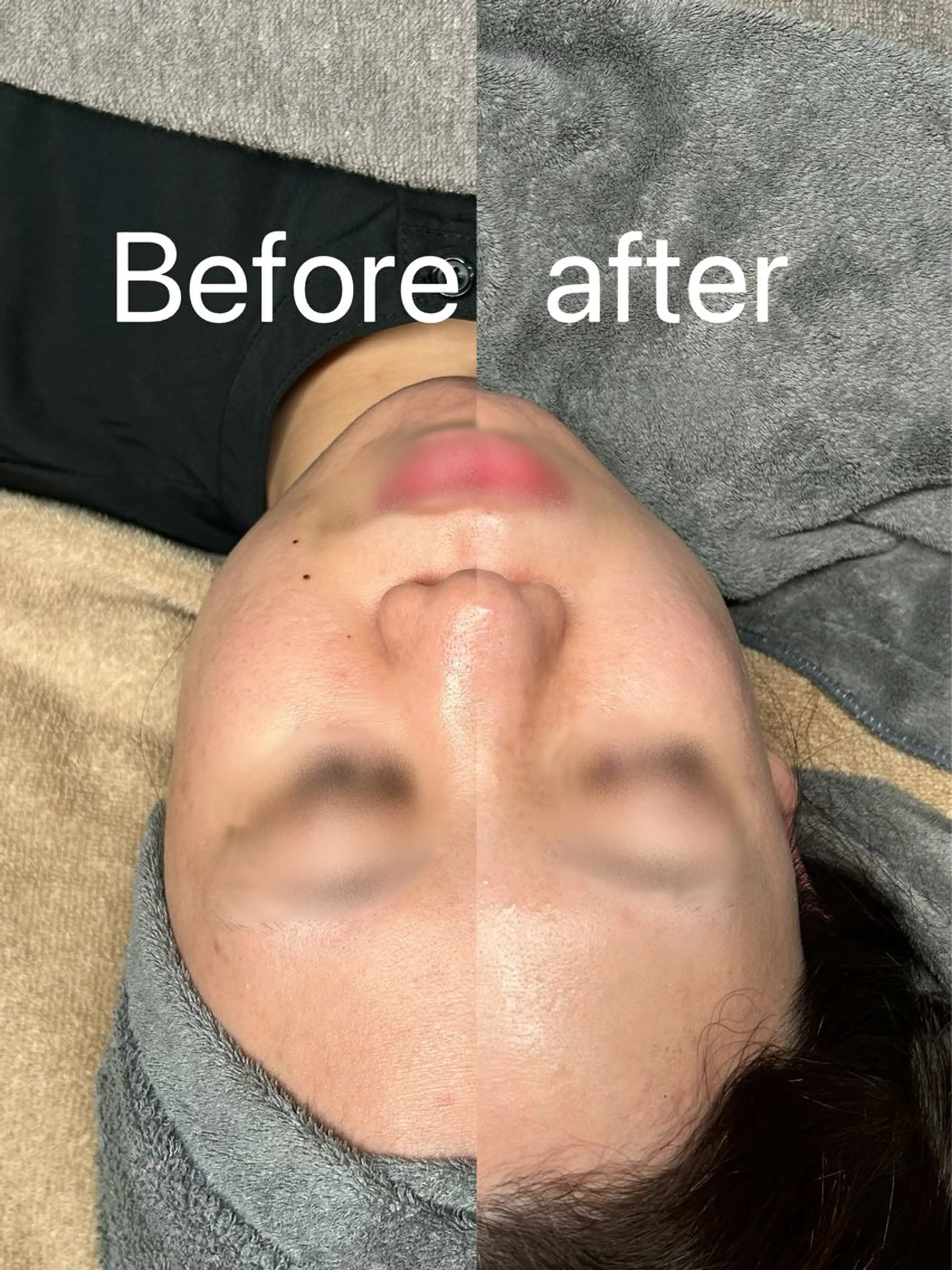 エステ Smoo アユミの眉毛・アイブロウイメージ