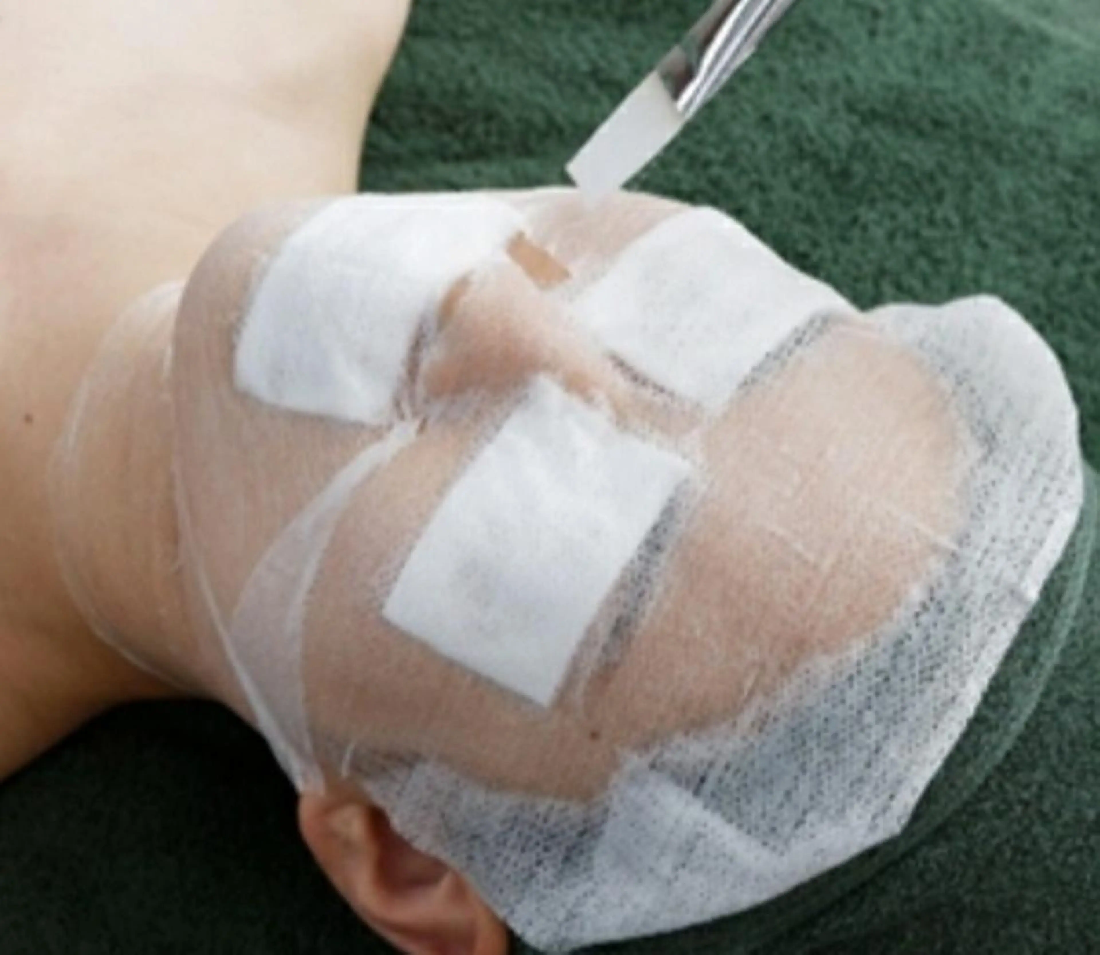 【お肌を育てる】つや肌白玉ピーリング デコルテリンパ+美白パック付¥7800→¥6,800の写真