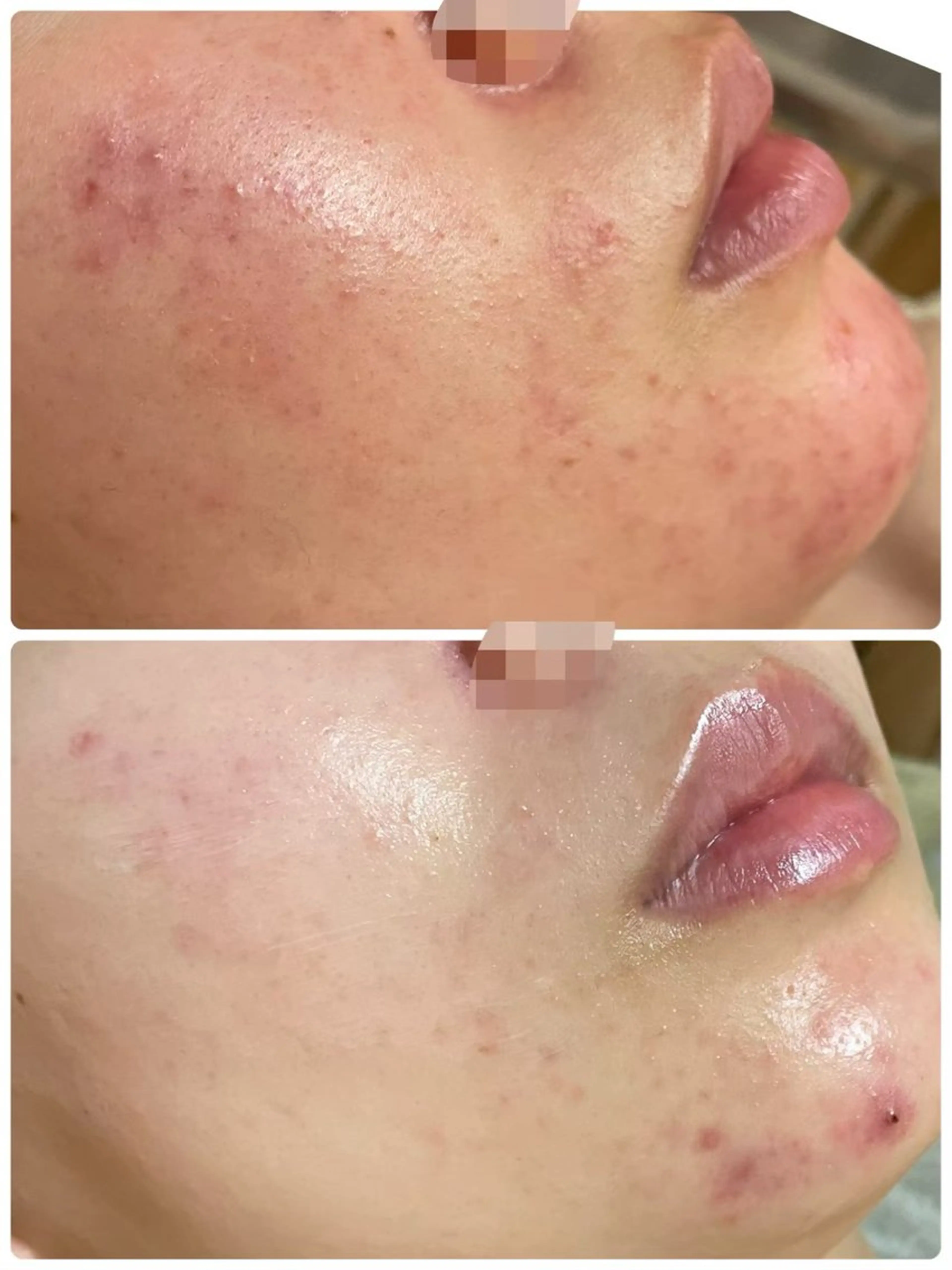 エステ ハーブピーリング　美肌サロン　health and beauty maki所属・ハーブピーリング 美肌サロン　makiのエステ・リラクイメージ