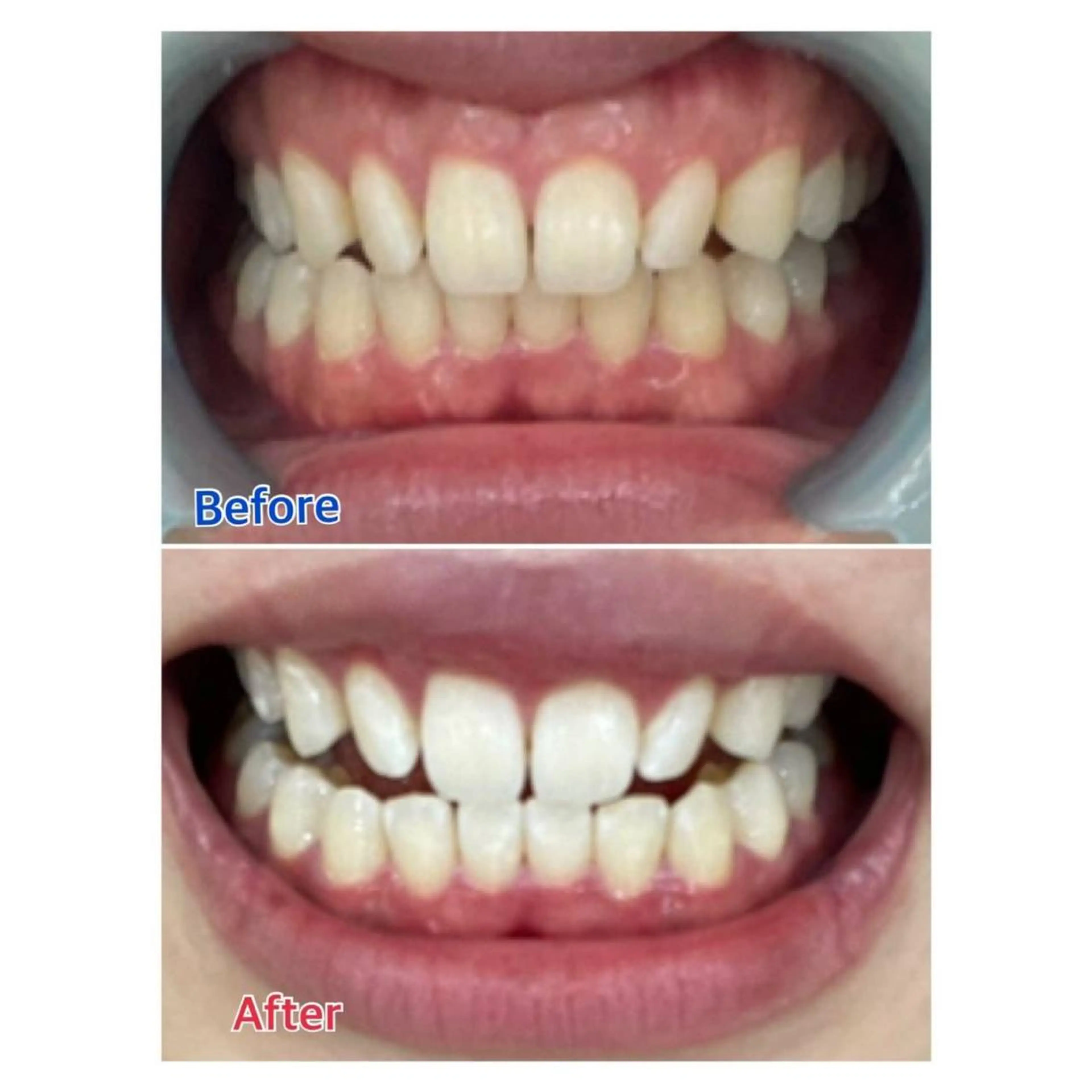 MBEAUTYSALON 千葉店・京成大久保所属・Melty 輝のその他イメージ