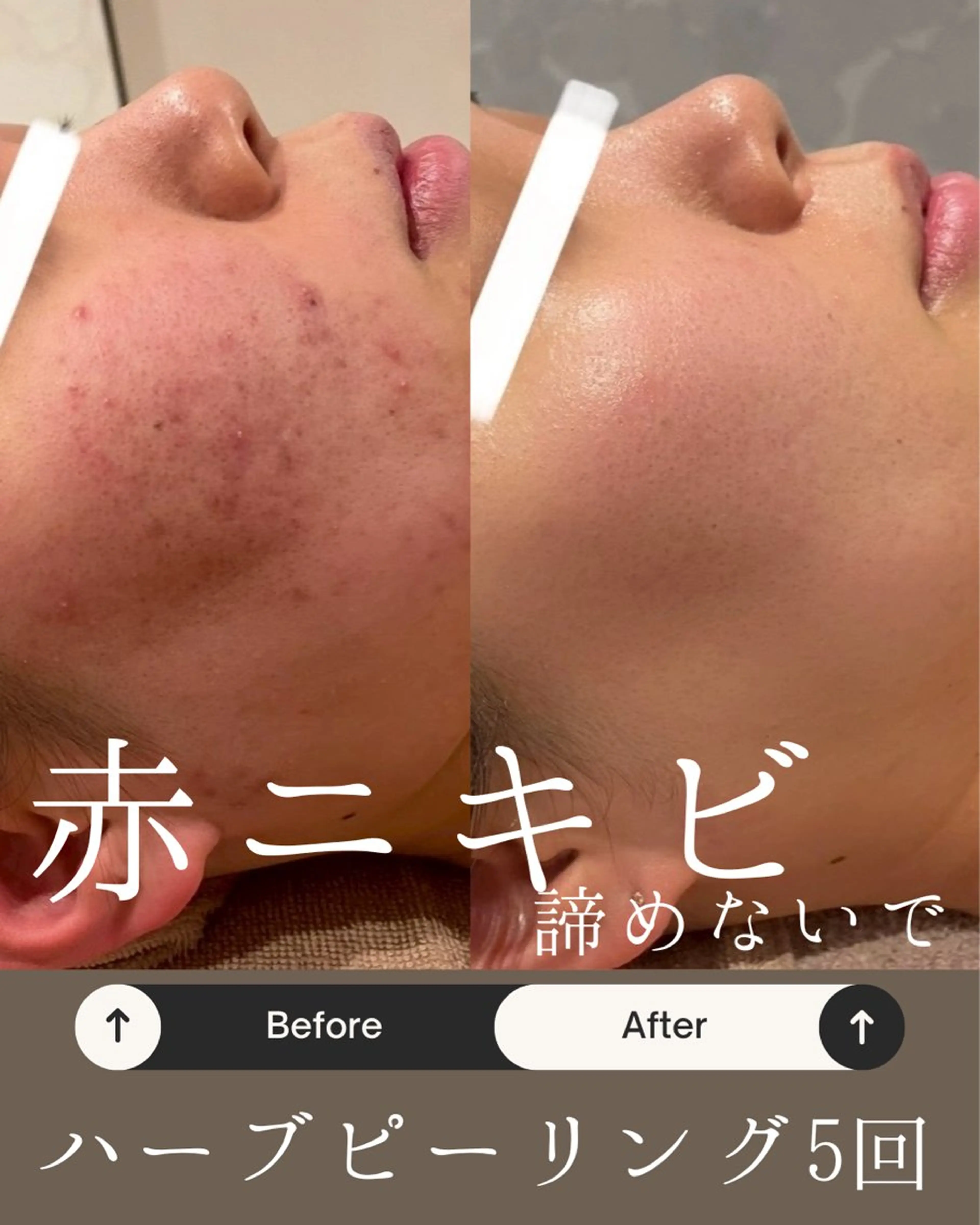 Anpawman所属・Anpawman アンパウマンのエステ・リラクイメージ