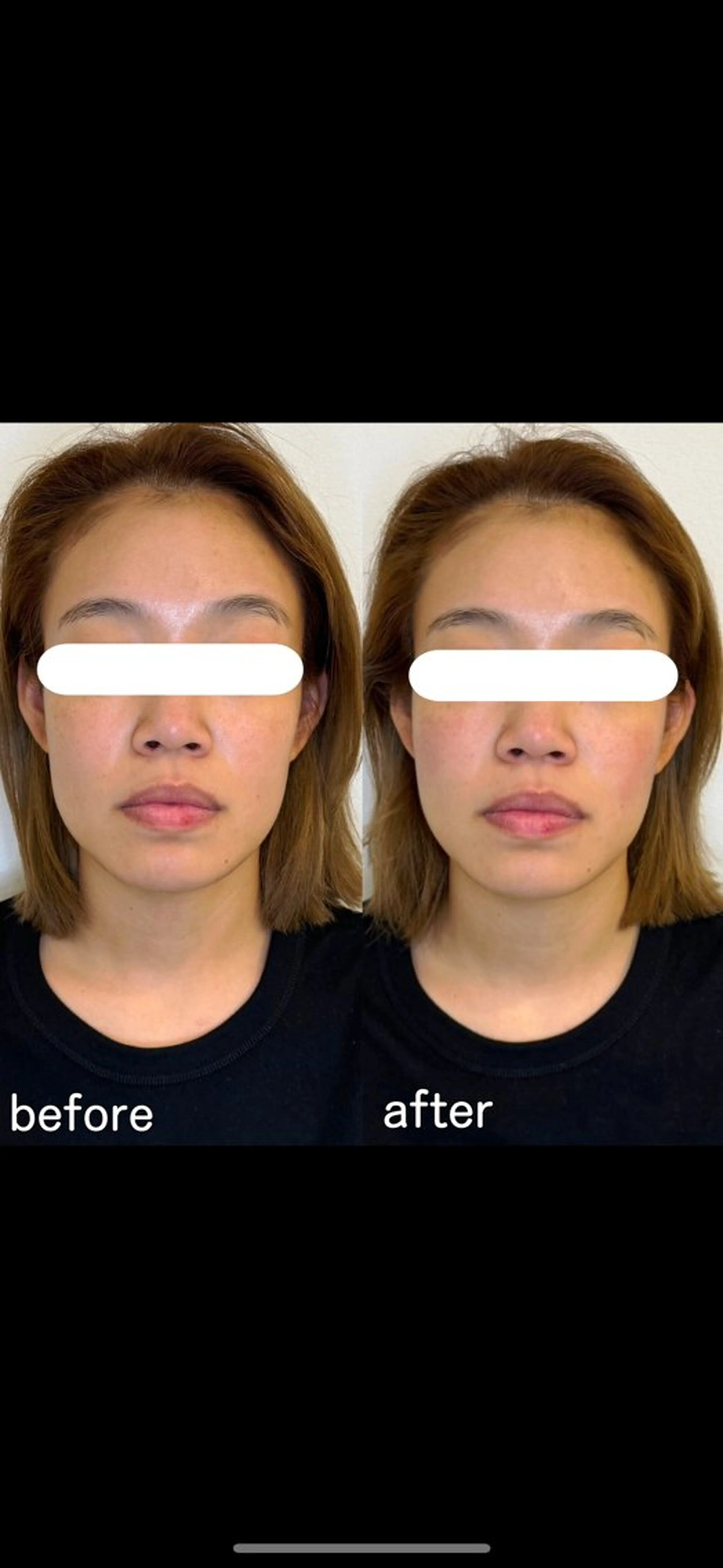 小顔矯正&美容整体 整え屋REDオーナーのエステ・リラクイメージ